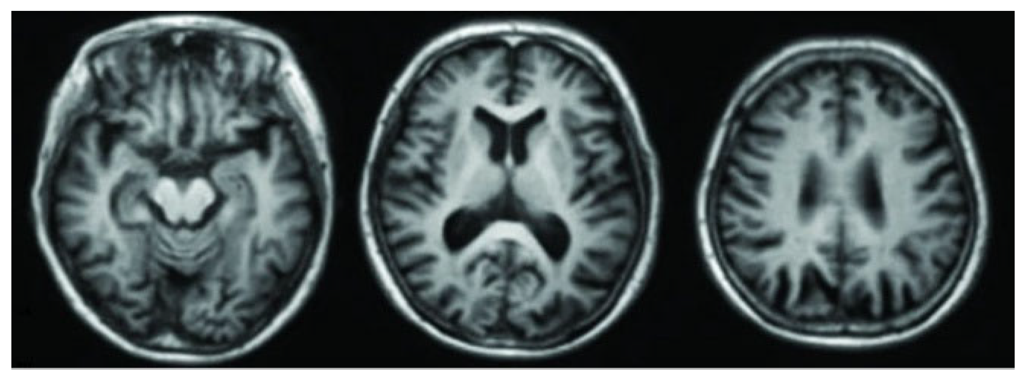 Algorithms 18 00434 g005