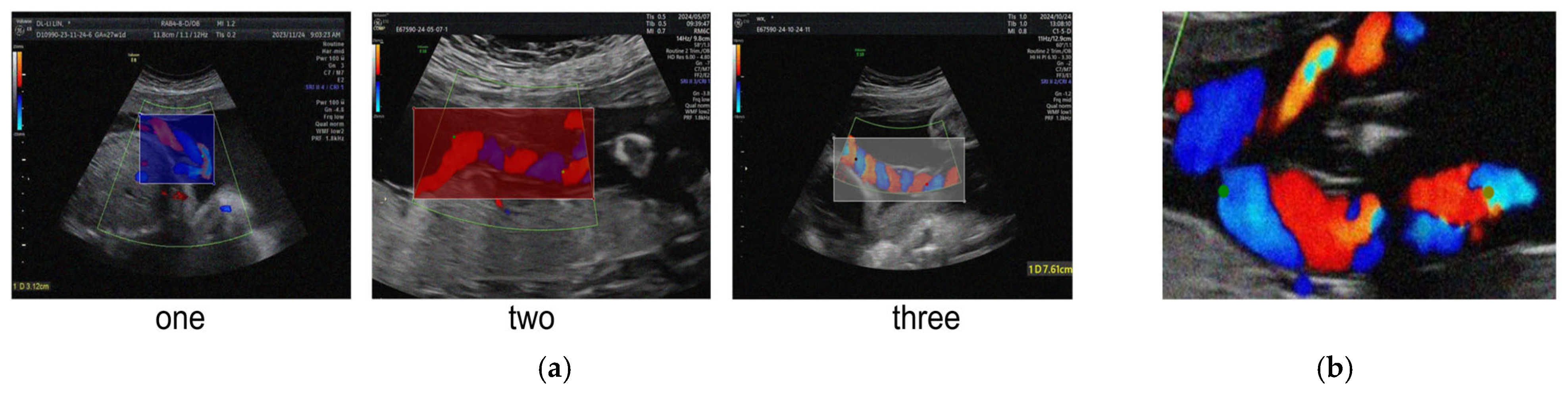 Algorithms 18 00592 g006