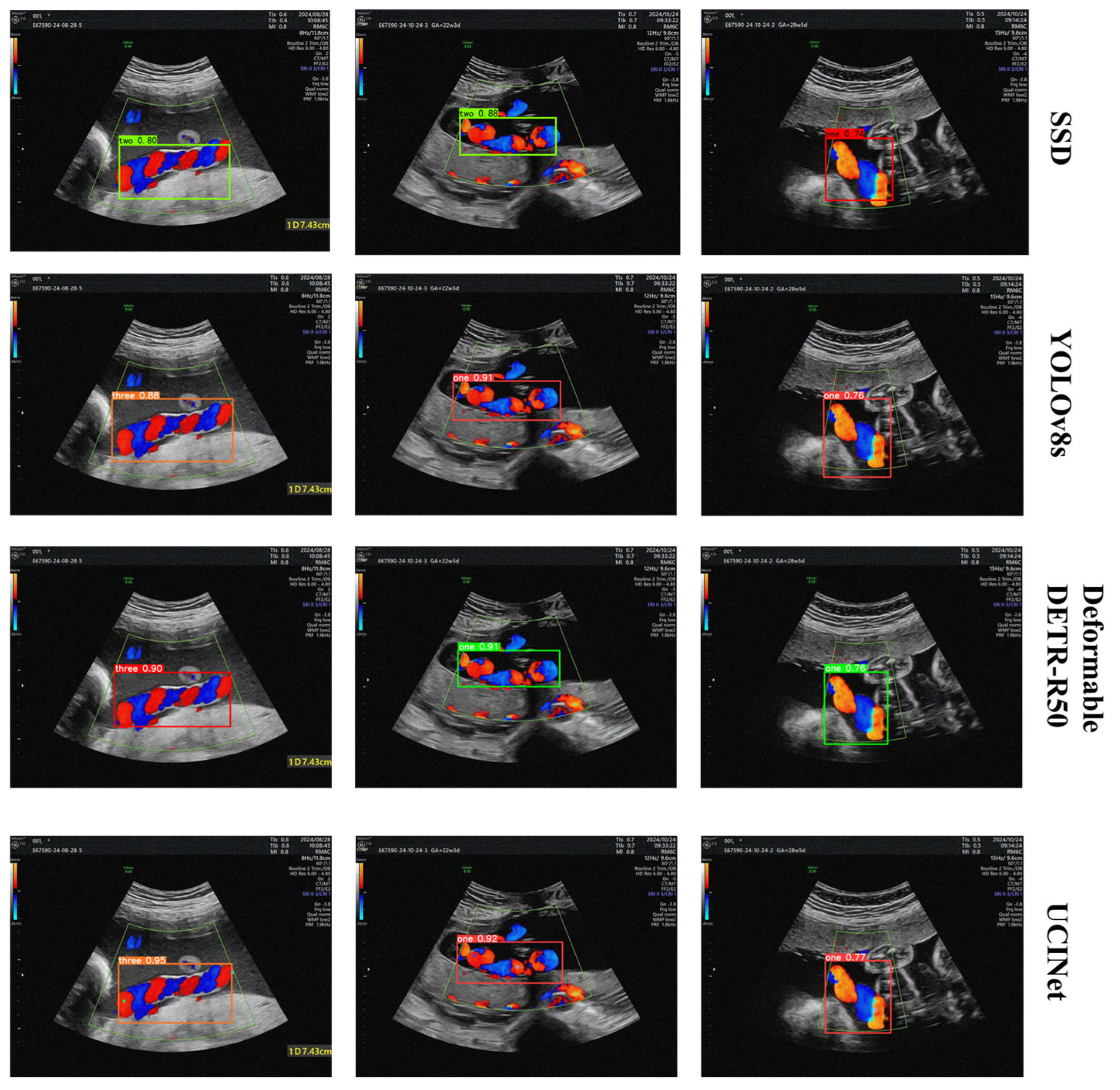 Algorithms 18 00592 g008