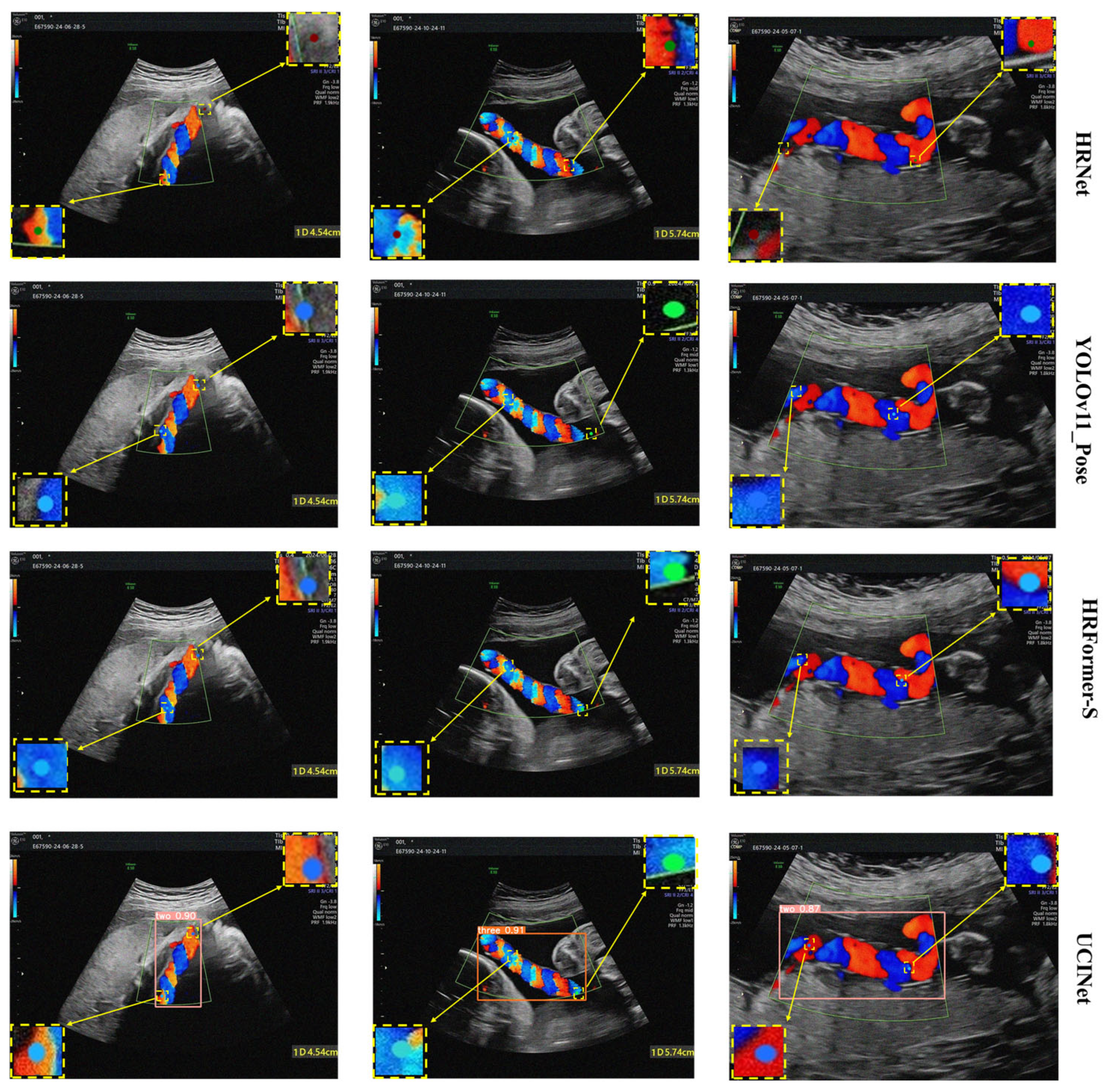 Algorithms 18 00592 g009