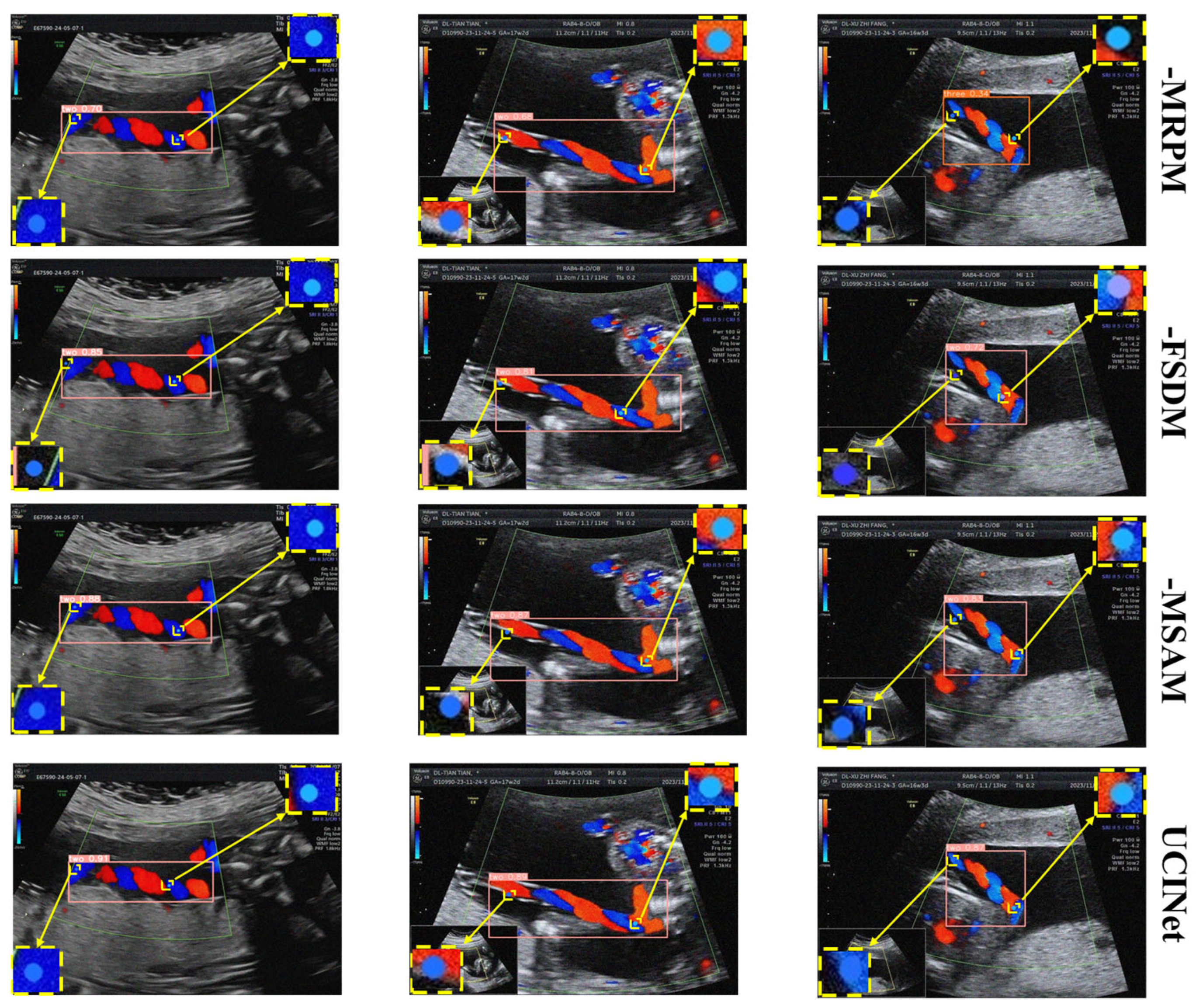 Algorithms 18 00592 g014
