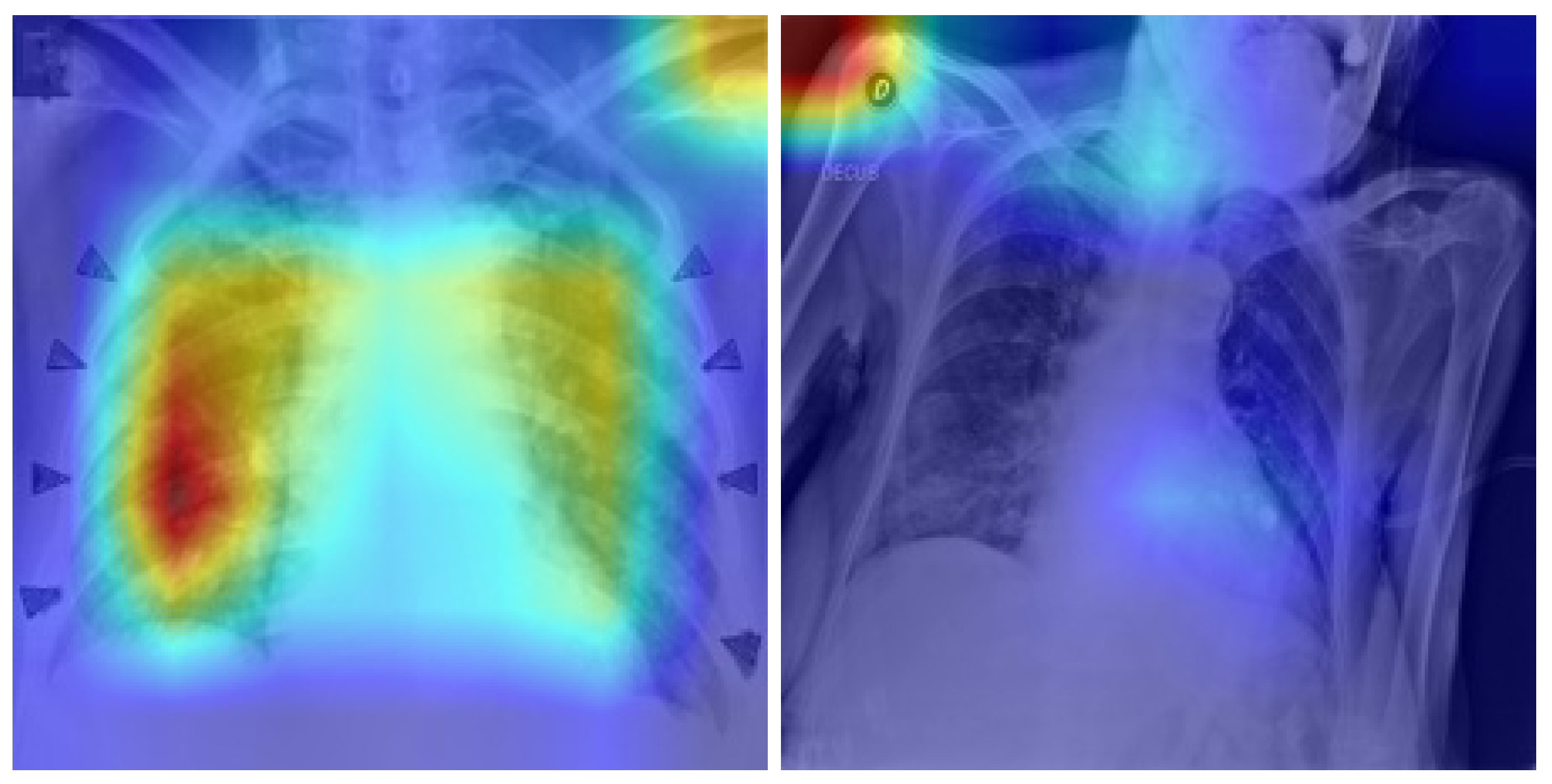 Algorithms 18 00730 g016