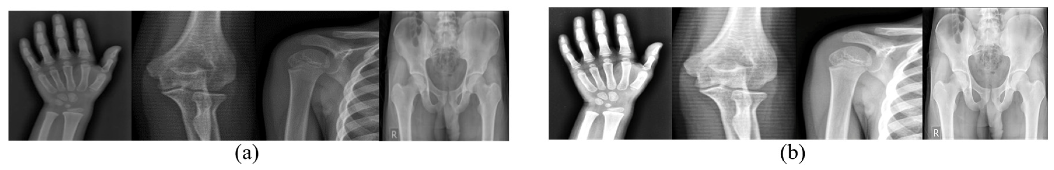 Algorithms 18 00765 g003