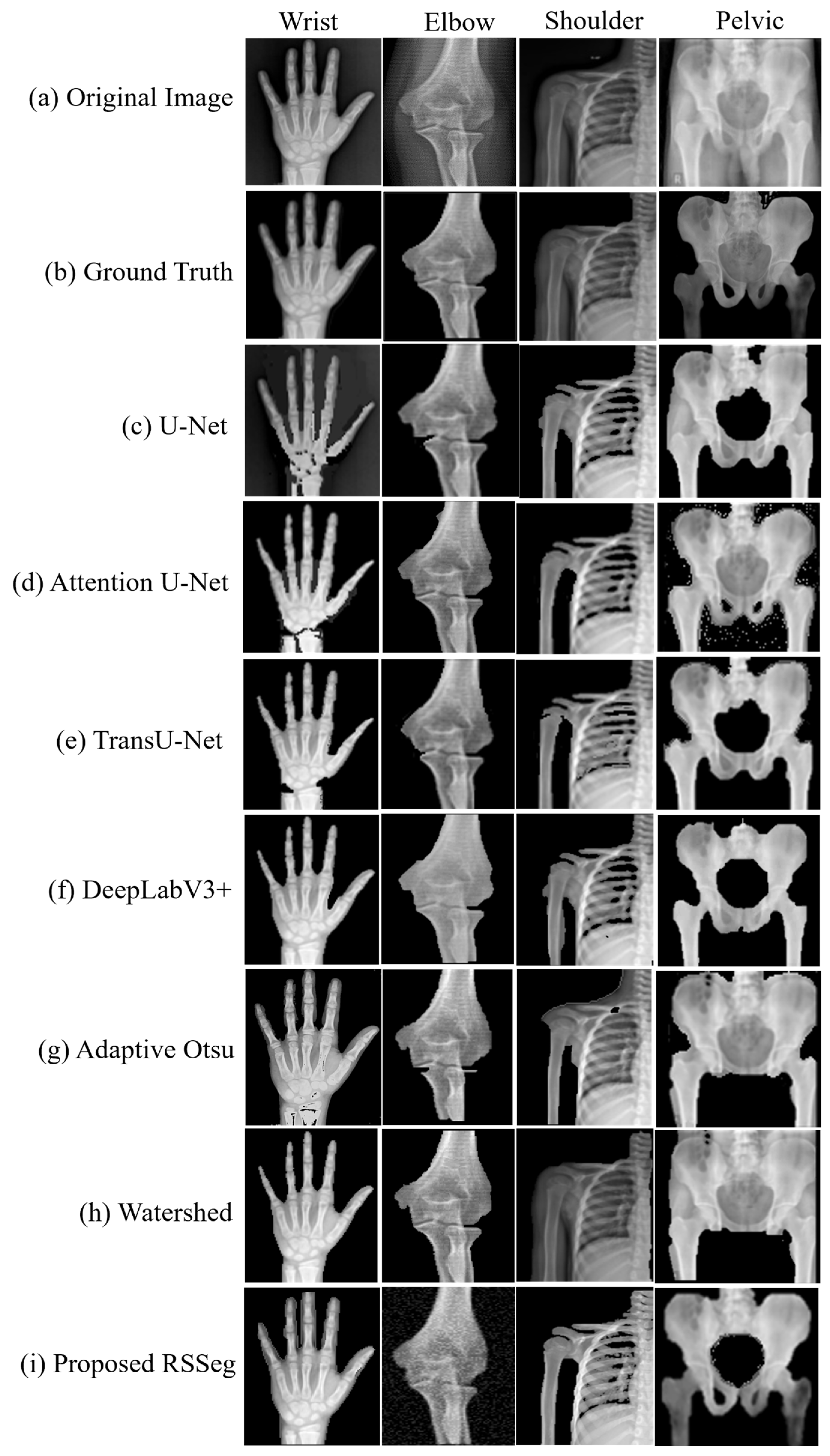 Algorithms 18 00765 g005
