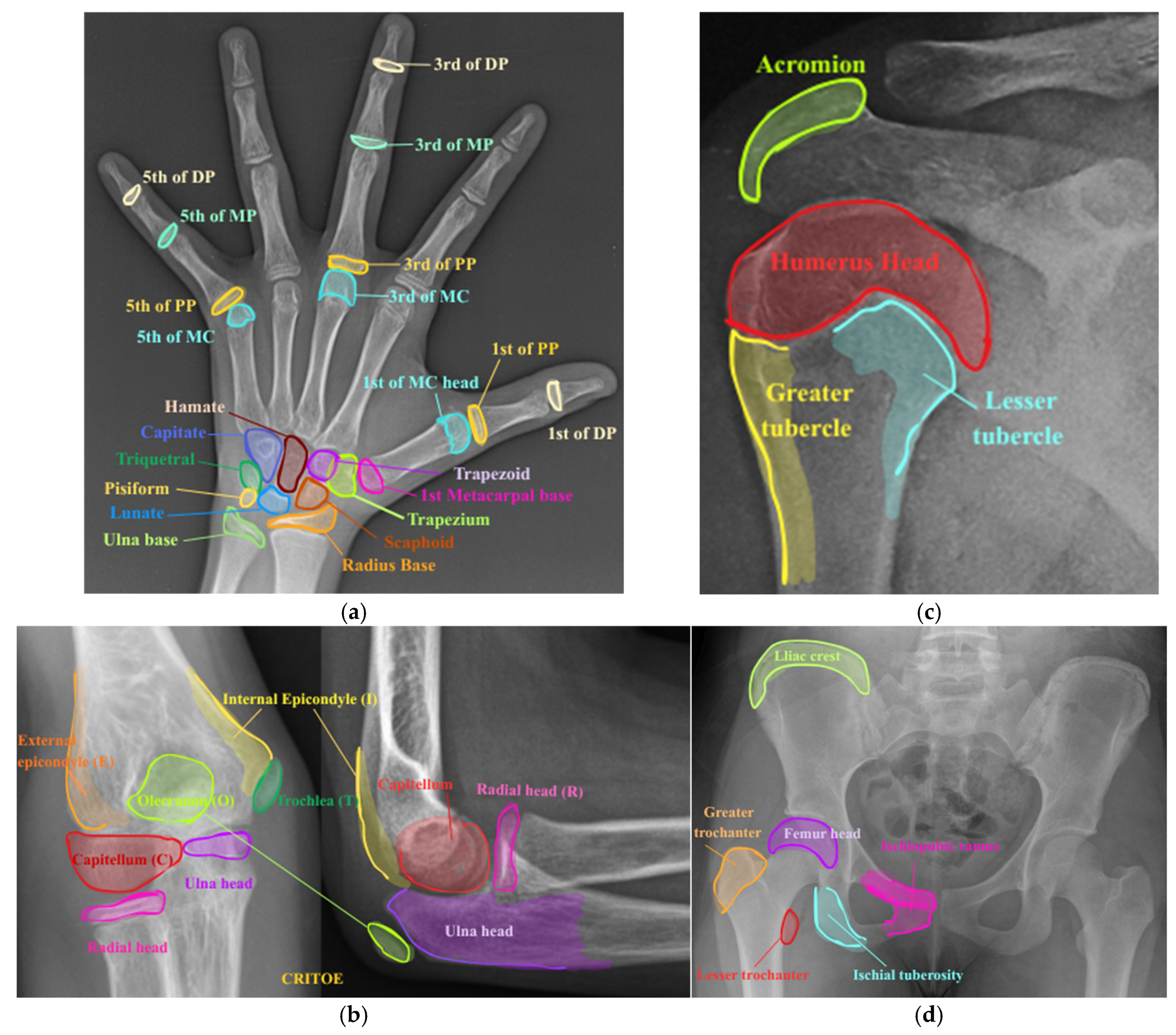Algorithms 18 00765 g007