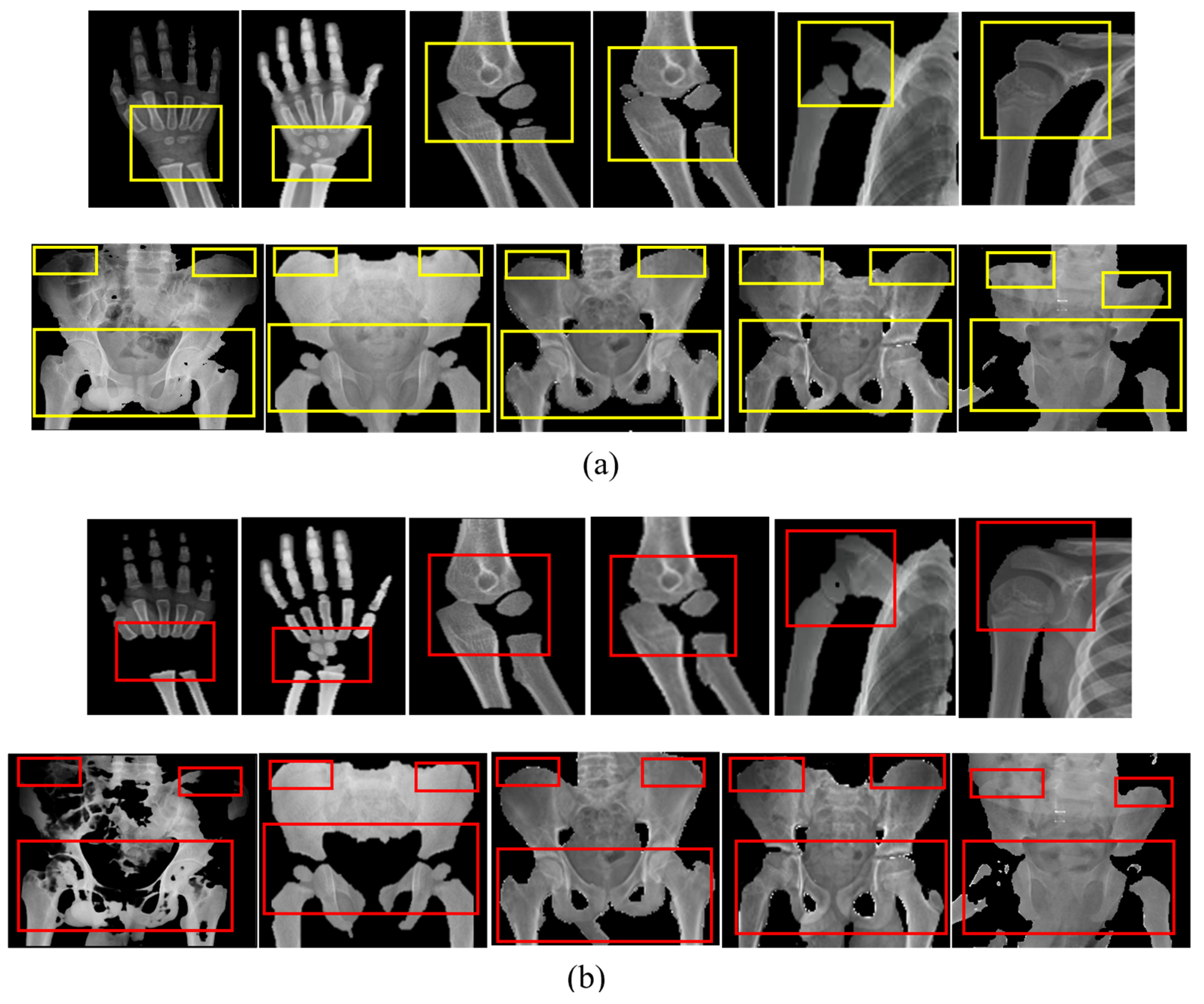 Algorithms 18 00765 g013