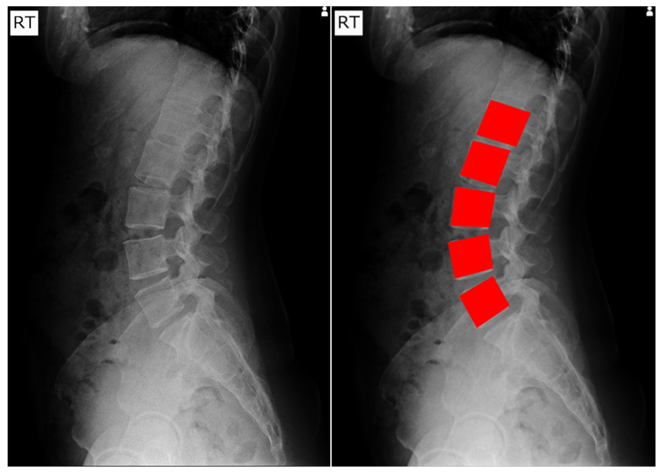 Algorithms 18 00796 g001