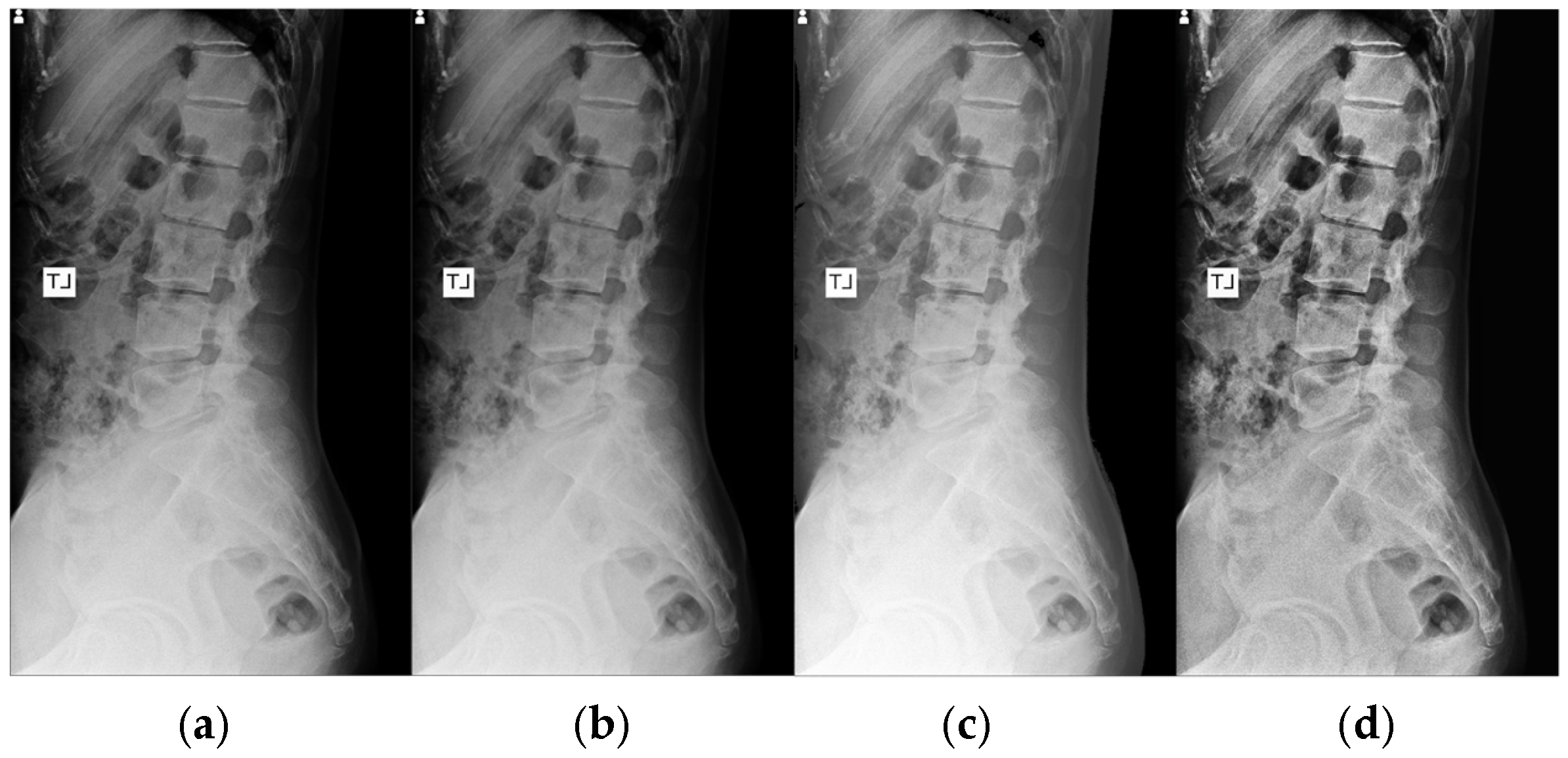 Algorithms 18 00796 g002