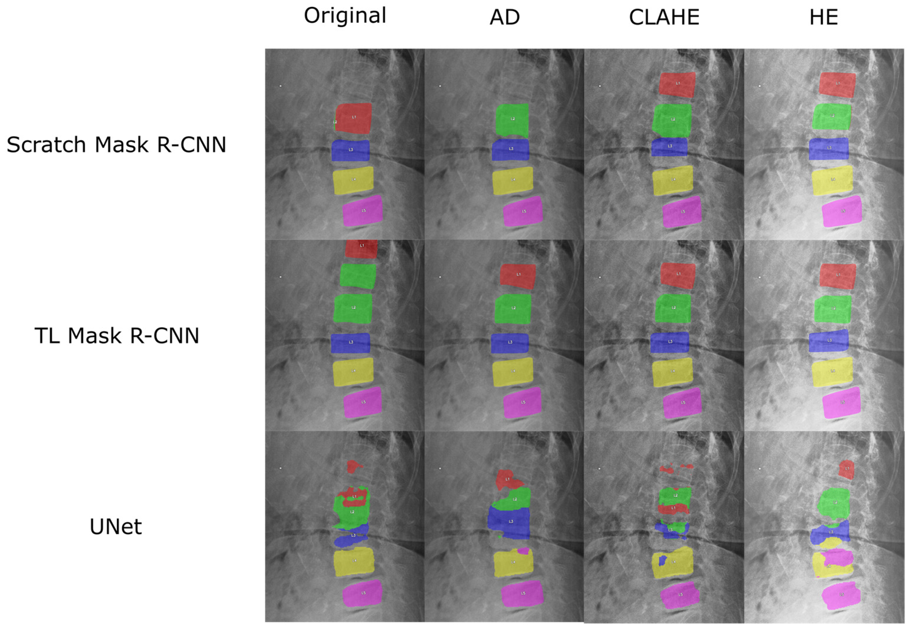 Algorithms 18 00796 g011