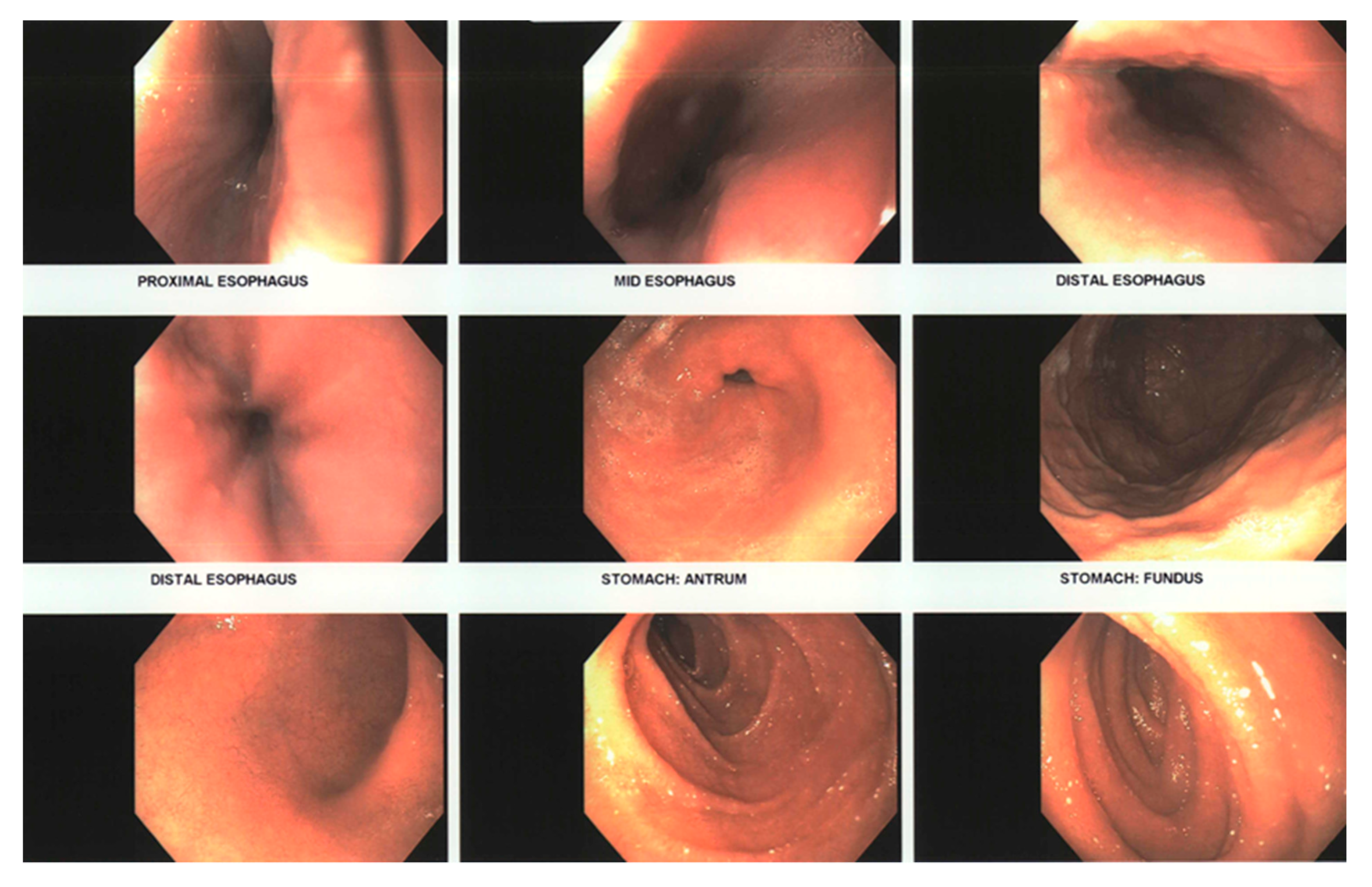 Allergies 01 00016 g001 550