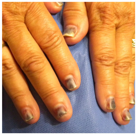 Is Nail Polish Toxic? – ORLY