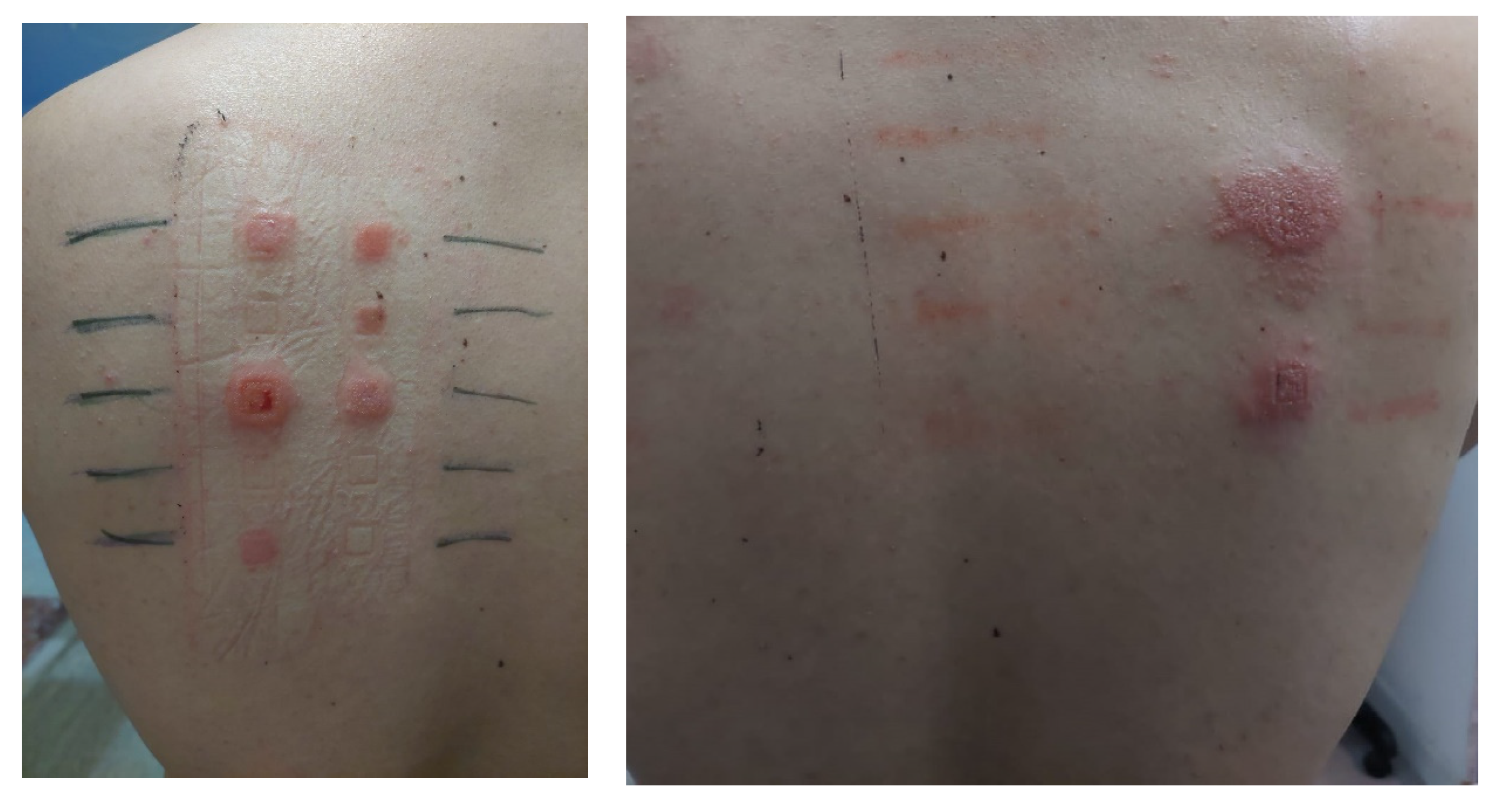 Allergies 02 00007 g002 550