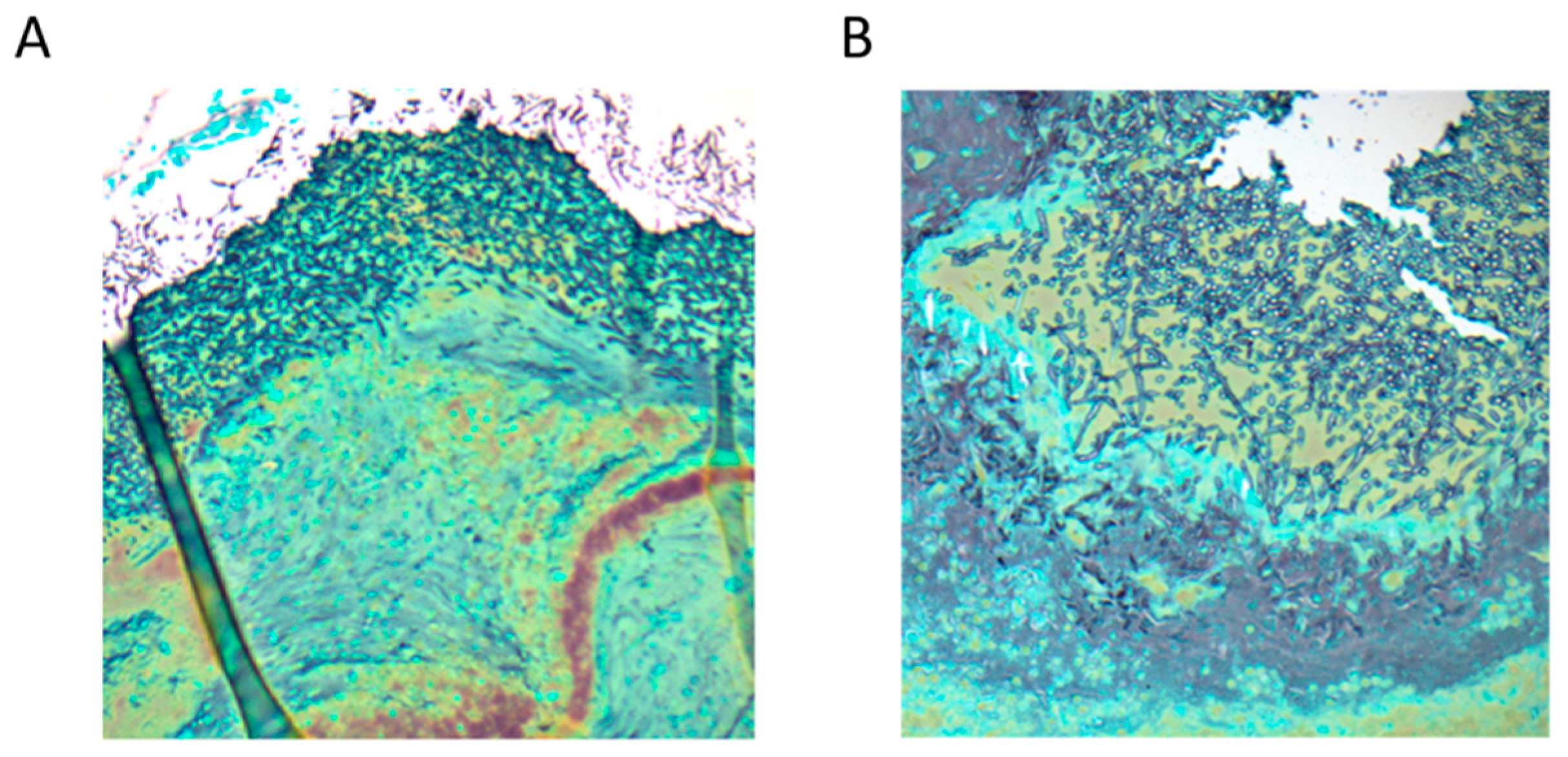 Allergies 02 00012 g003
