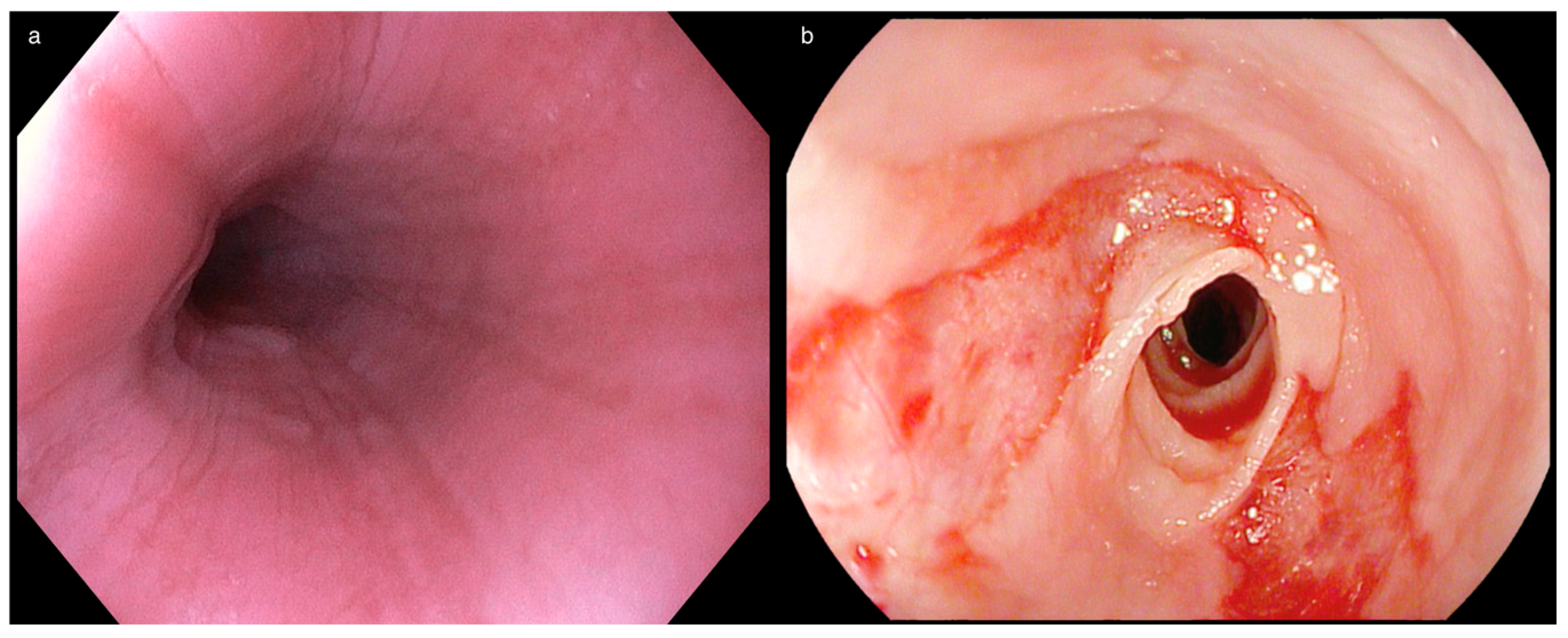Allergies 05 00017 g002