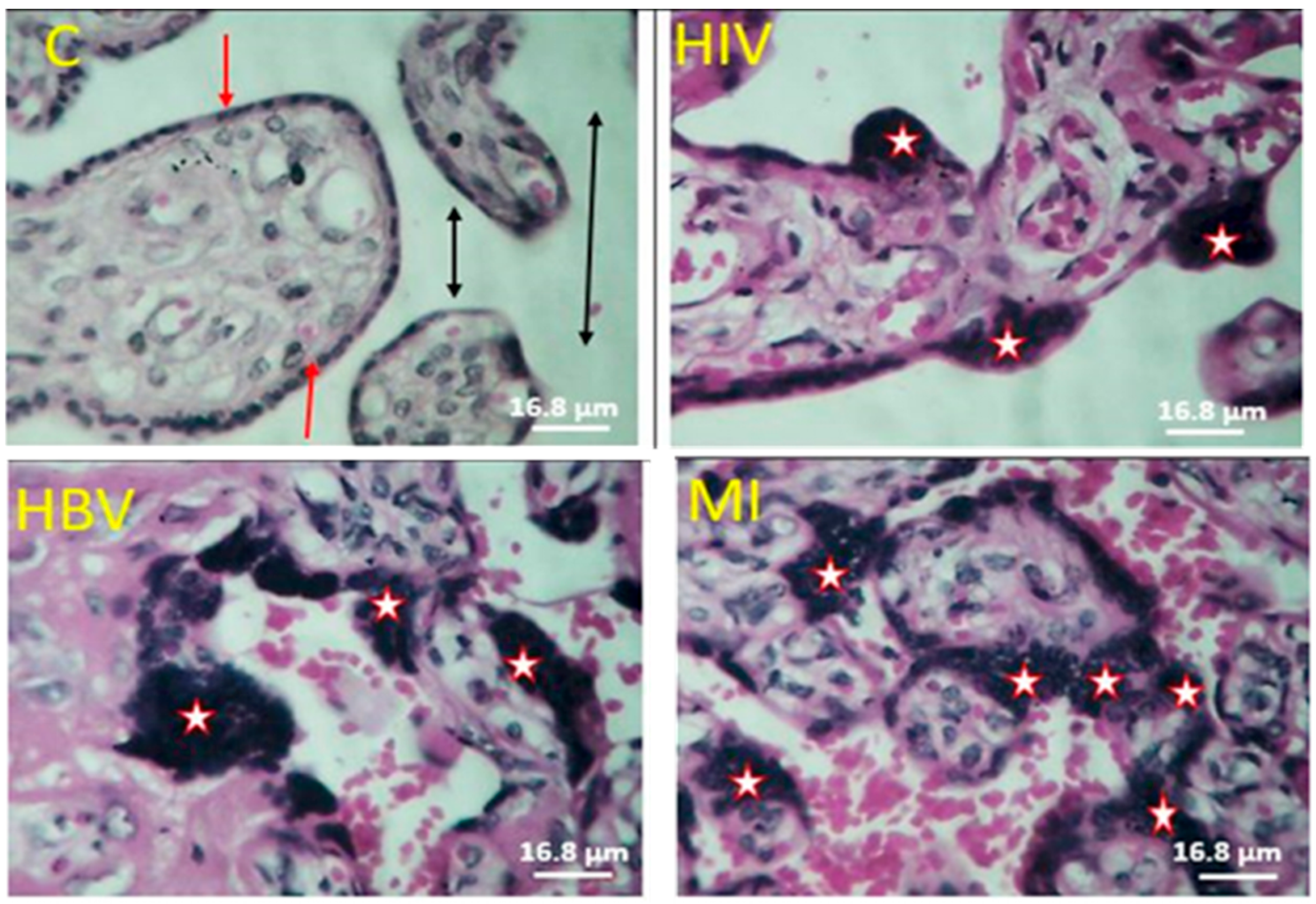 Amh 69 00005 g004 Amh 69 00005 g004