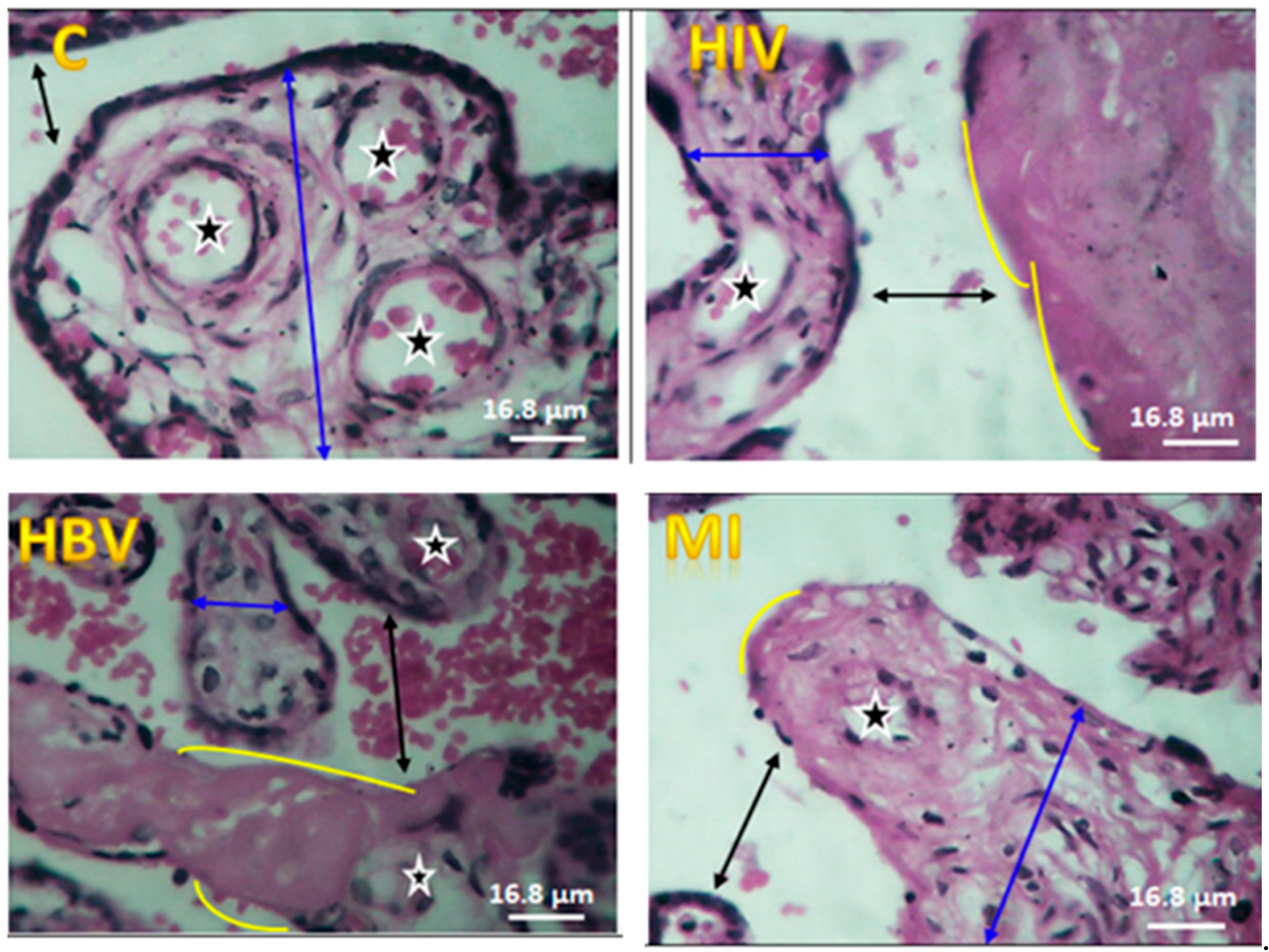 Amh 69 00005 g005 Amh 69 00005 g005