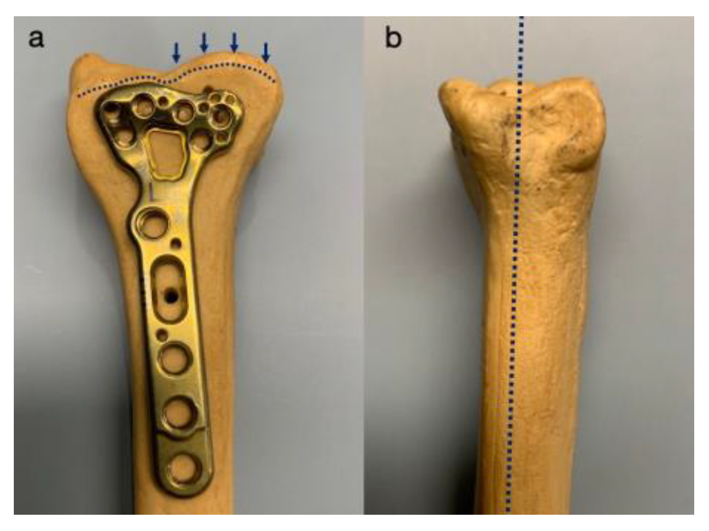 Anatomia Free FullText Do Anatomical Differences of the Volar Rim