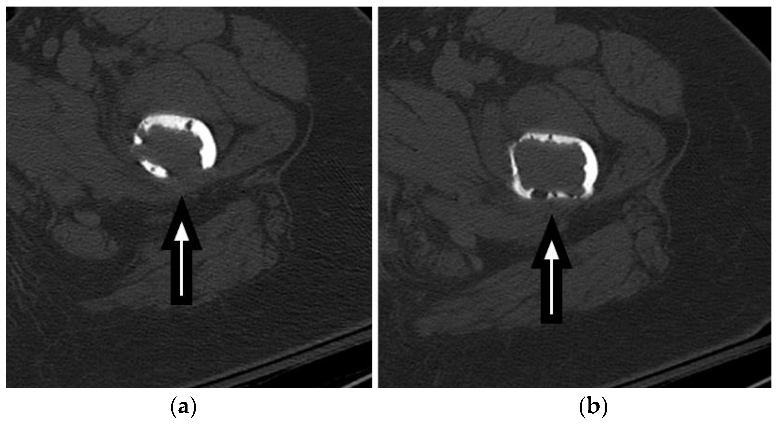 Anatomia 02 00026 g004a