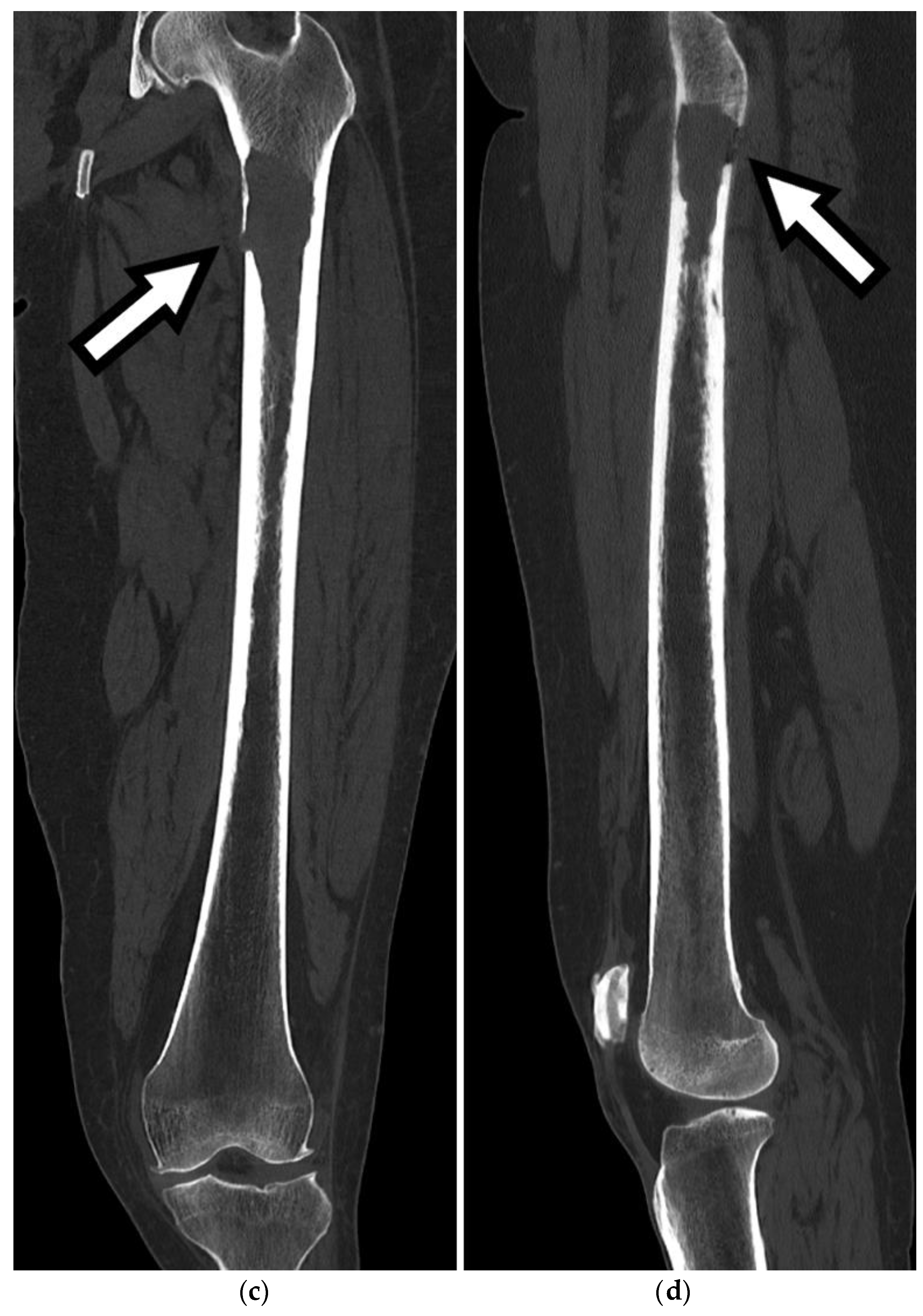 Anatomia 02 00026 g004b