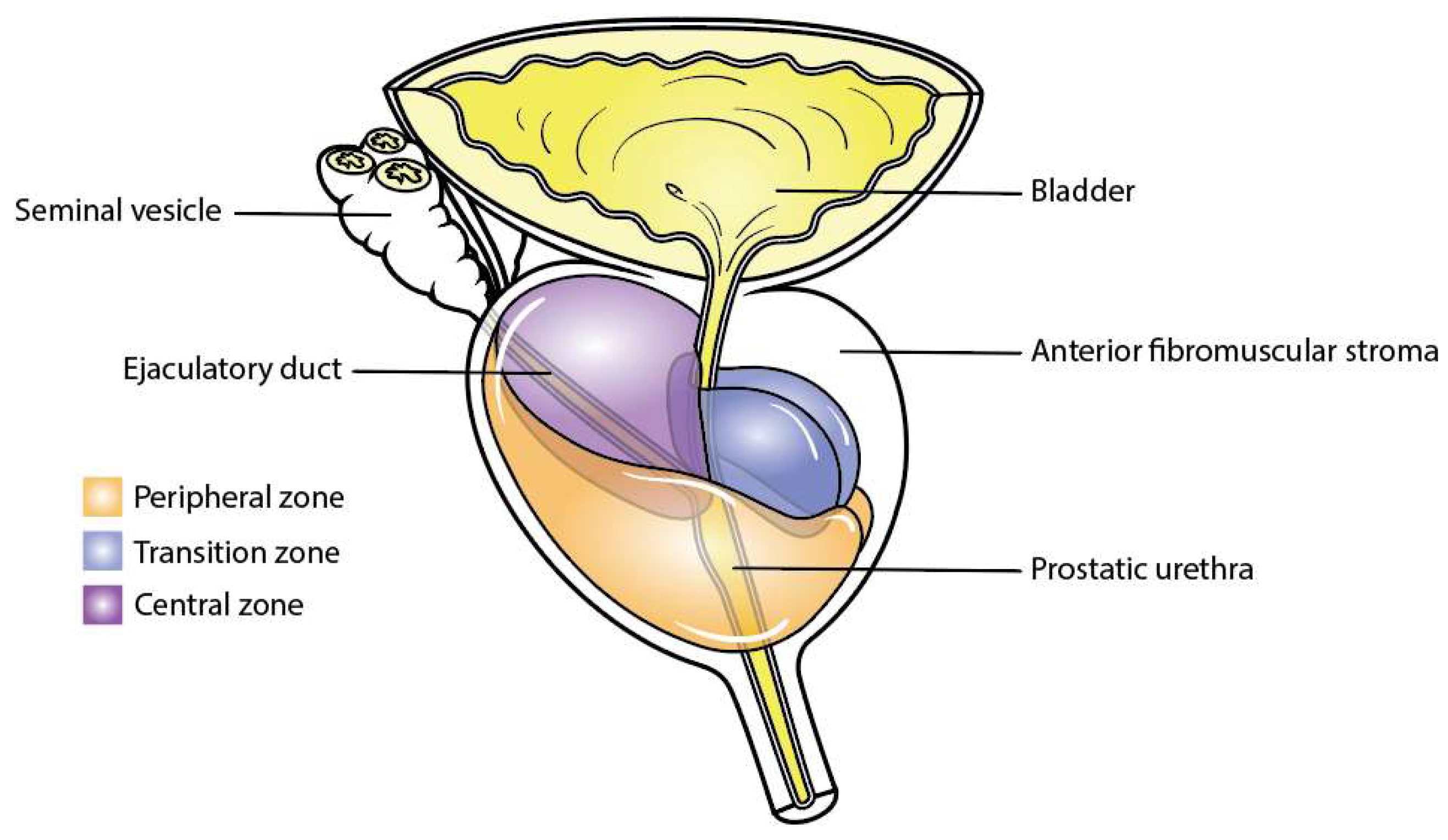 Anatomia free full text molecular anatomy of prostate cancer and