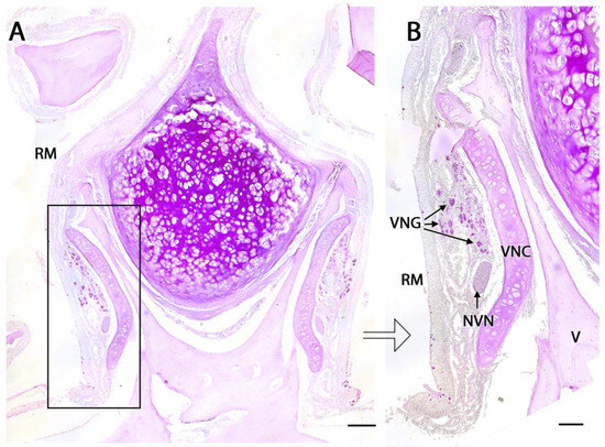 Pheromone Sensing in Mammals: A Review of the Vomeronasal System