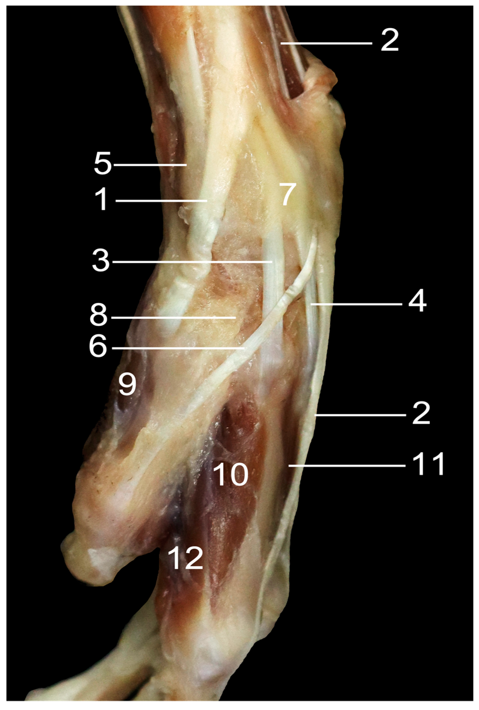 Anatomia 03 00013 g005 Anatomia 03 00013 g005