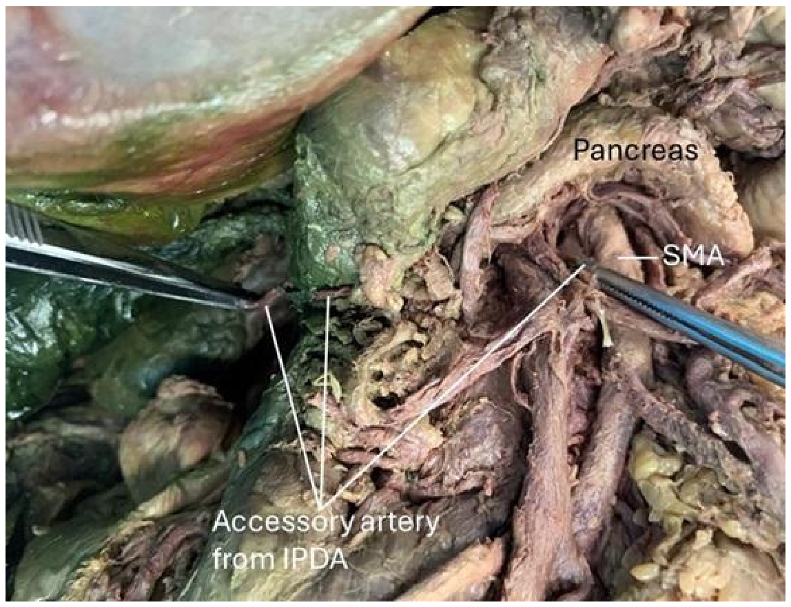 Anatomia 05 00016 g005 Anatomia 05 00016 g005
