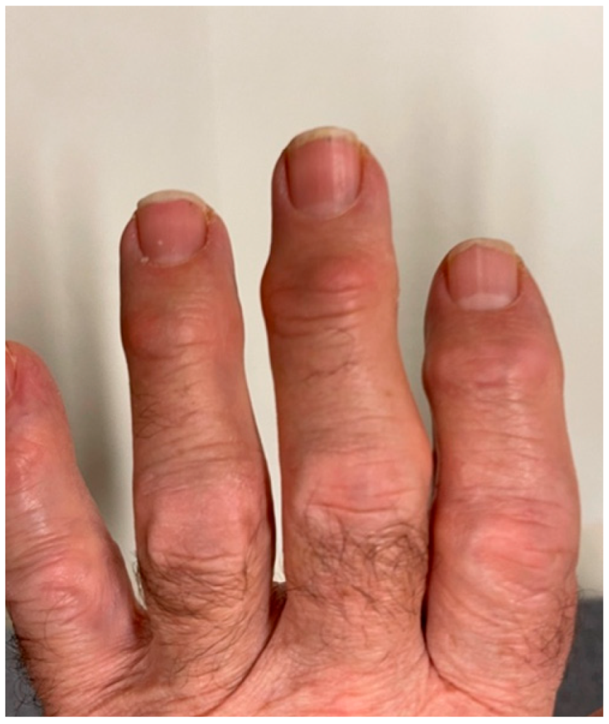 Anesthres 01 00008 g002