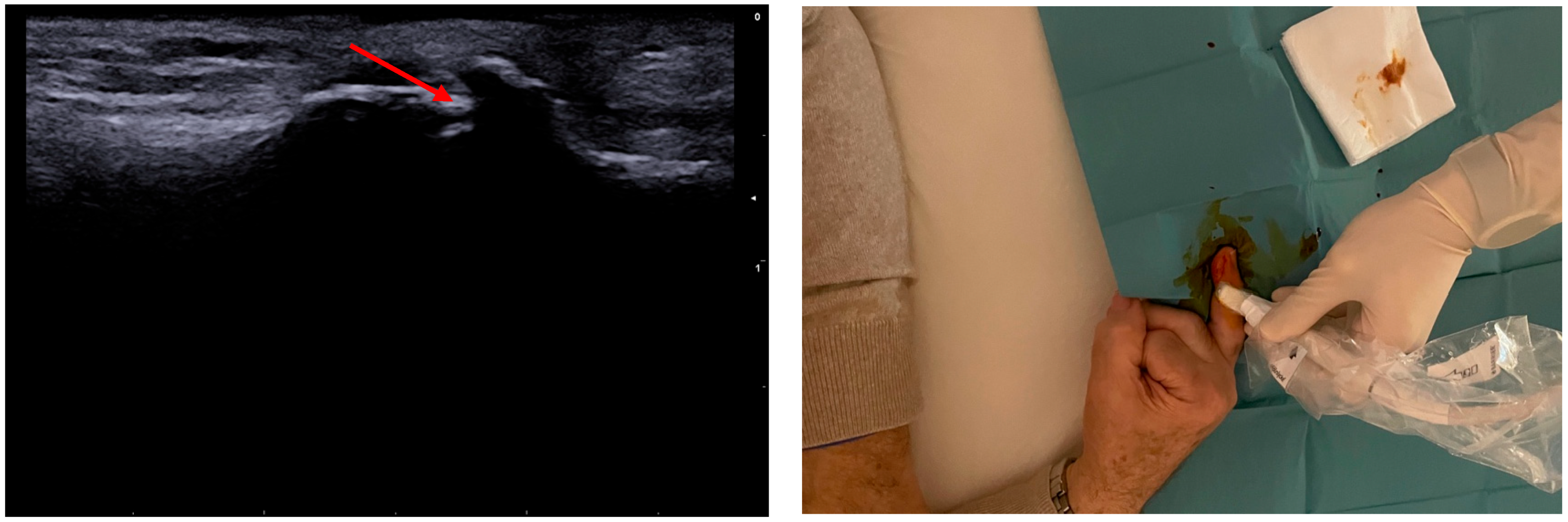 Anesthres 01 00008 g003