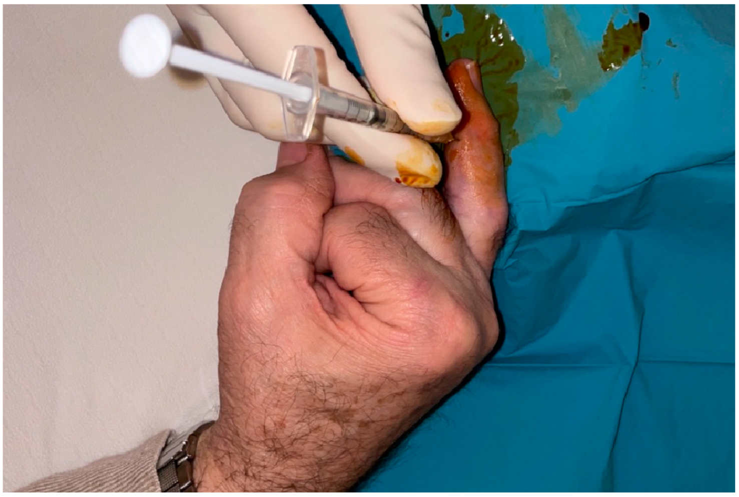 Anesthres 01 00008 g005