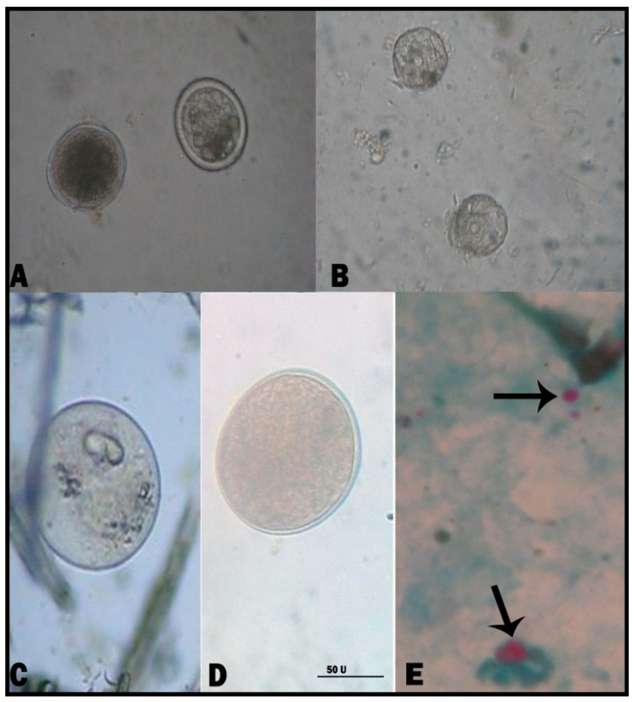 Animals | Free Full-Text | Diversity of Parasitic Diarrhea Associated with  Buxtonella Sulcata in Cattle and Buffalo Calves with Control of  Buxtonellosis