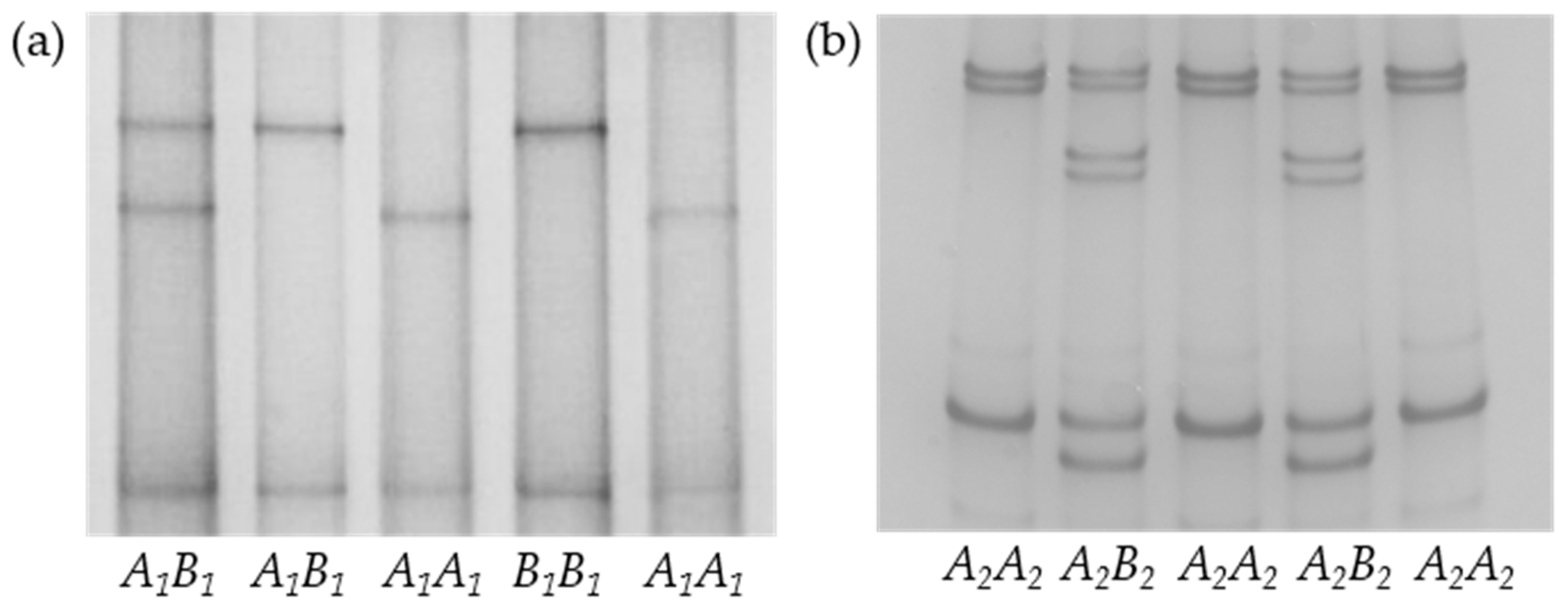 Animals | Free Full-Text | Variation in the Fatty Acid Synthase Gene (FASN) Its Association with Milk Traits in Gannan Yaks | HTML