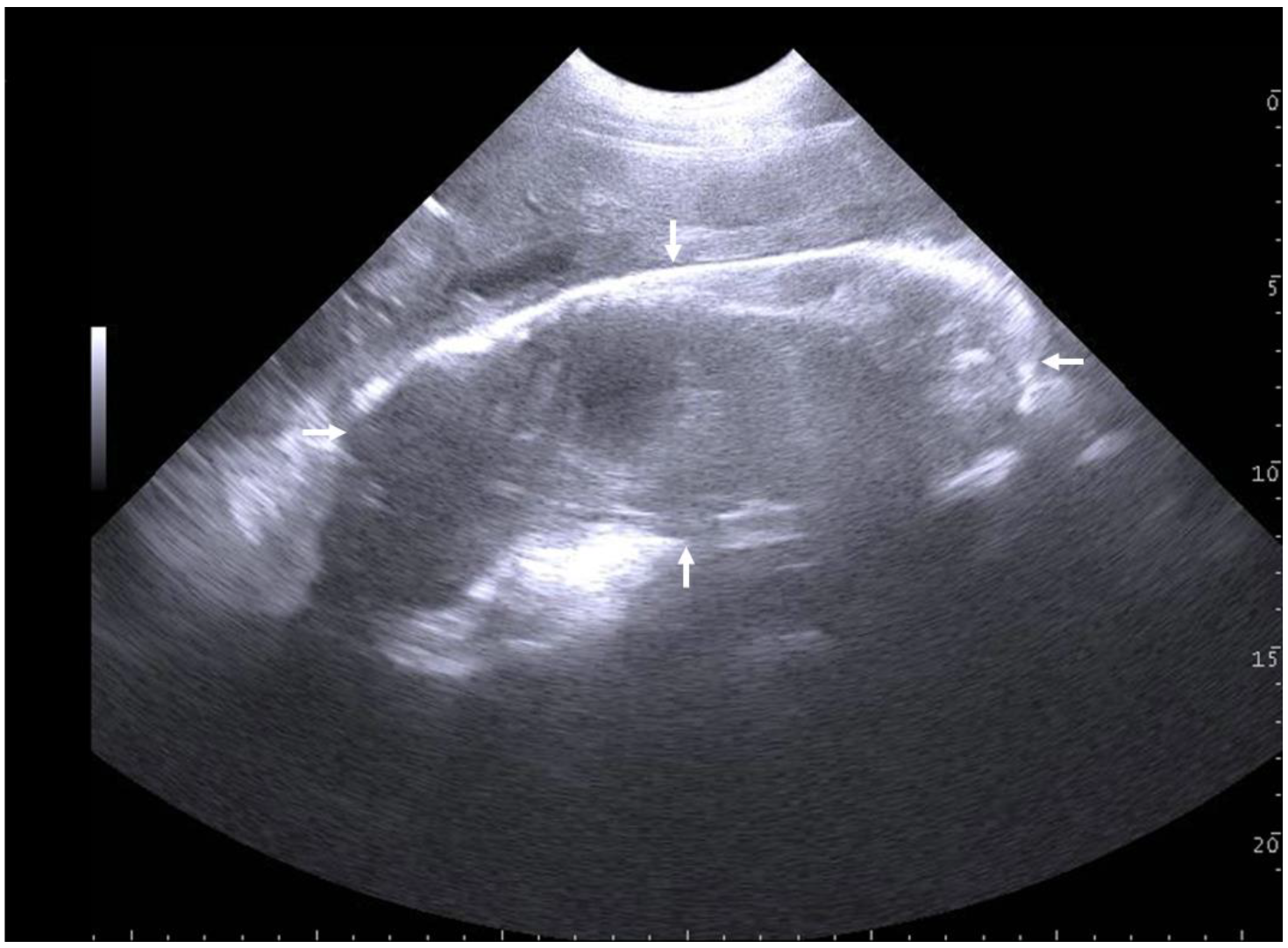 Ultrasound Probe Cover, Transducer Disposable Clear Nederland