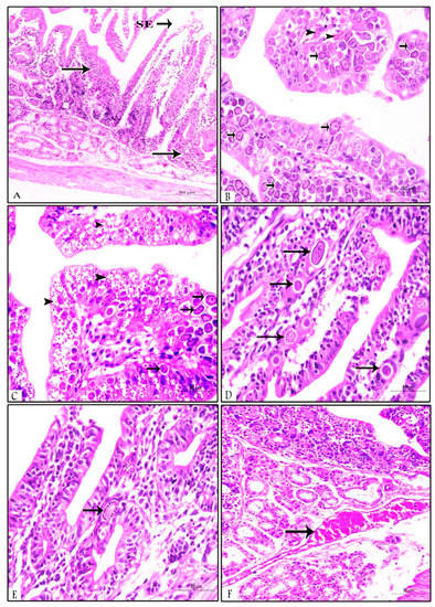 Prophylactic and Therapeutic Efficacy of Prebiotic Supplementation ...