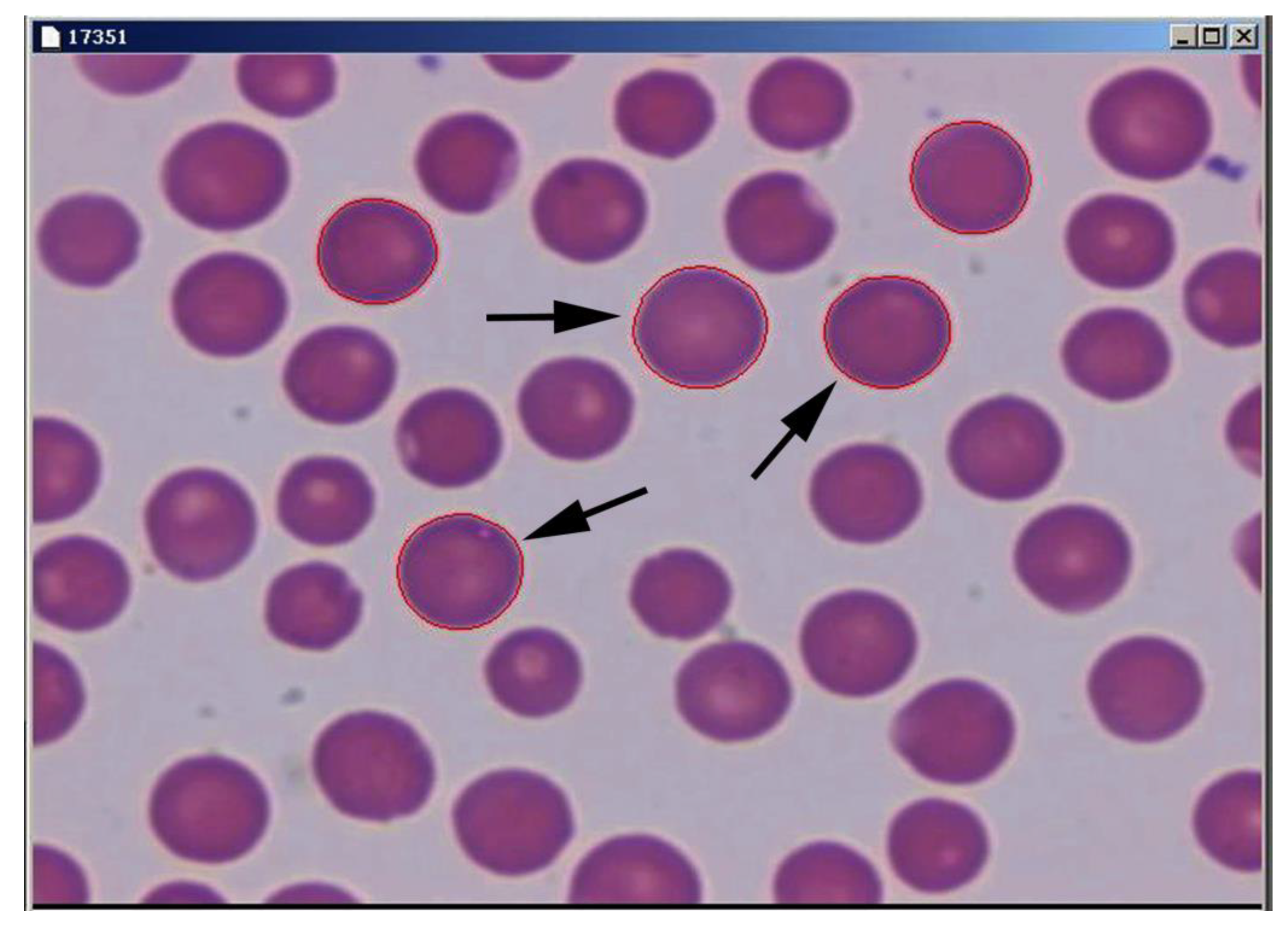 Animals | Free Full-Text | A New Method of Assessing Sheep Red Blood Cell Types from Their Morphology Animals | Free Full-Text | A New Method of Assessing Sheep Red Blood Cell Types from Their Morphology