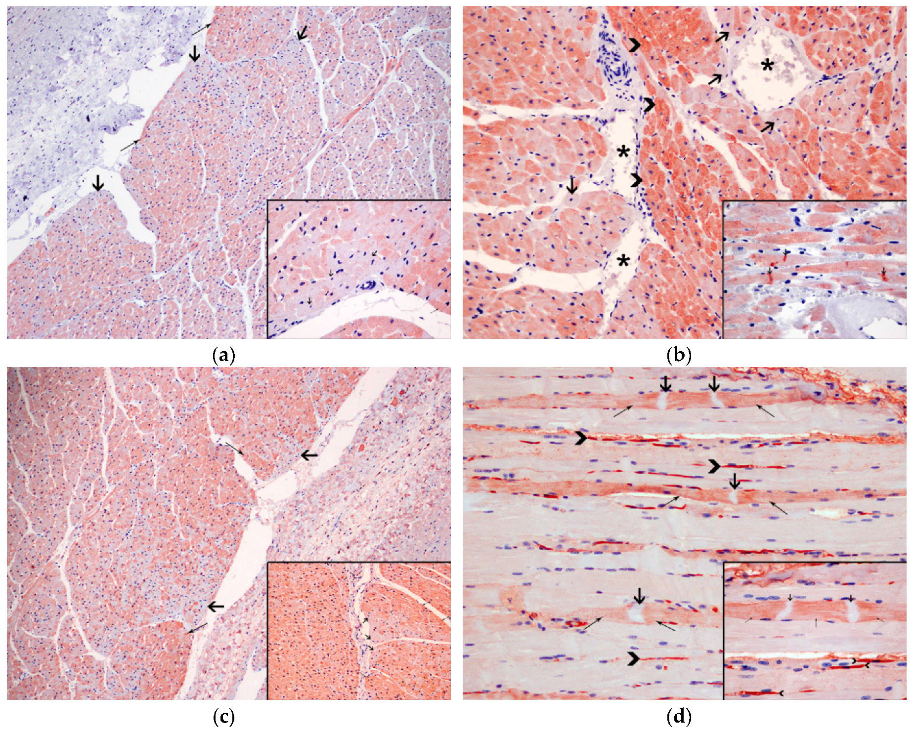 Animals | Free Full-Text | Capture Myopathy and Stress Cardiomyopathy in a Live-Stranded Risso's Dolphin (Grampus griseus) in Rehabilitation Animals | Free Full-Text | Capture Myopathy and Stress Cardiomyopathy in a Live-Stranded Risso's Dolphin (Grampus griseus) in Rehabilitation