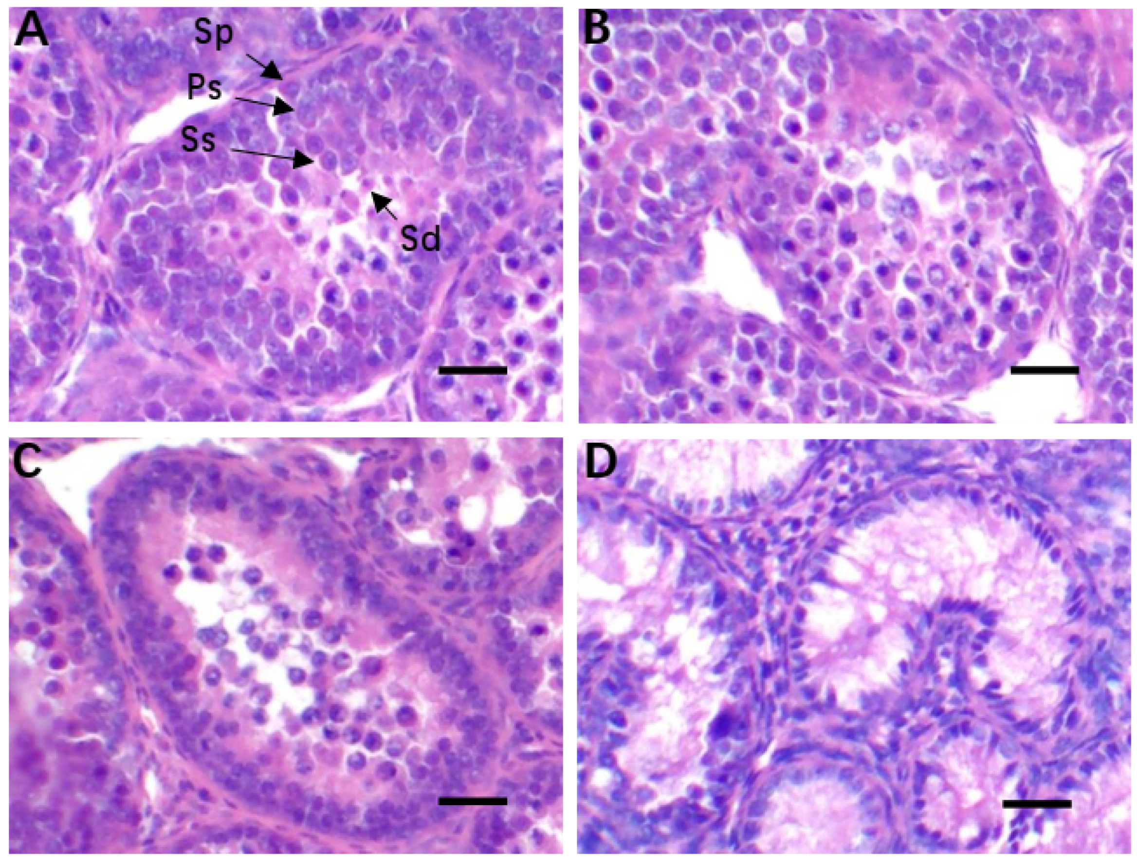 Animals | Free Full-Text | Oxidative Stress and Endoplasmic Reticulum Stress Are Involved in the Protective Effect of Alpha Lipoic Acid Against Heat Damage in Chicken Testes Animals | Free Full-Text | Oxidative Stress and Endoplasmic Reticulum Stress Are Involved in the Protective Effect of Alpha Lipoic Acid Against Heat Damage in Chicken Testes
