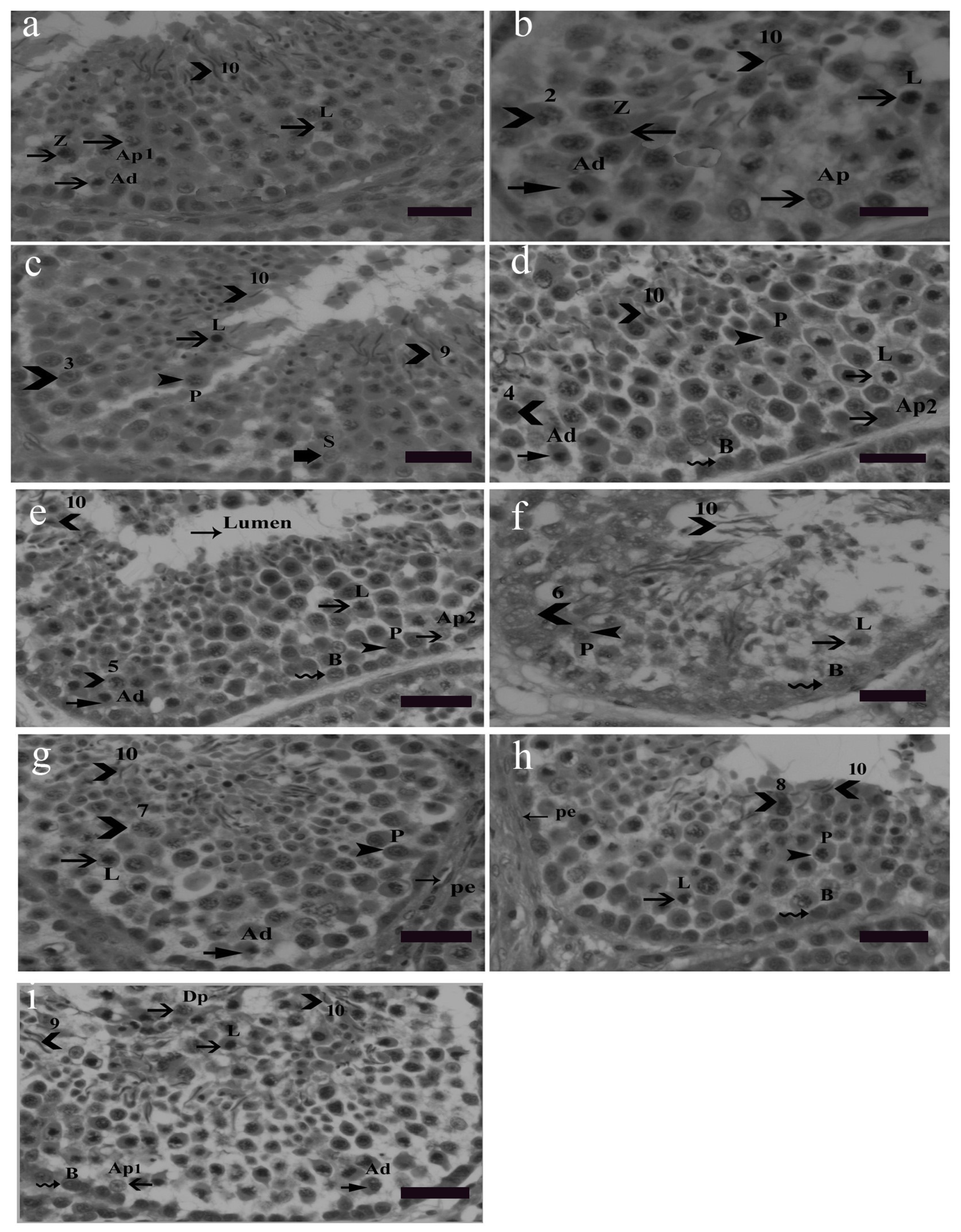 Animals | Free Full-Text | Spermiogenesis, Stages of Seminiferous  Epithelium and Variations in Seminiferous Tubules during Active States of  Spermatogenesis in Yangzhou Goose Ganders