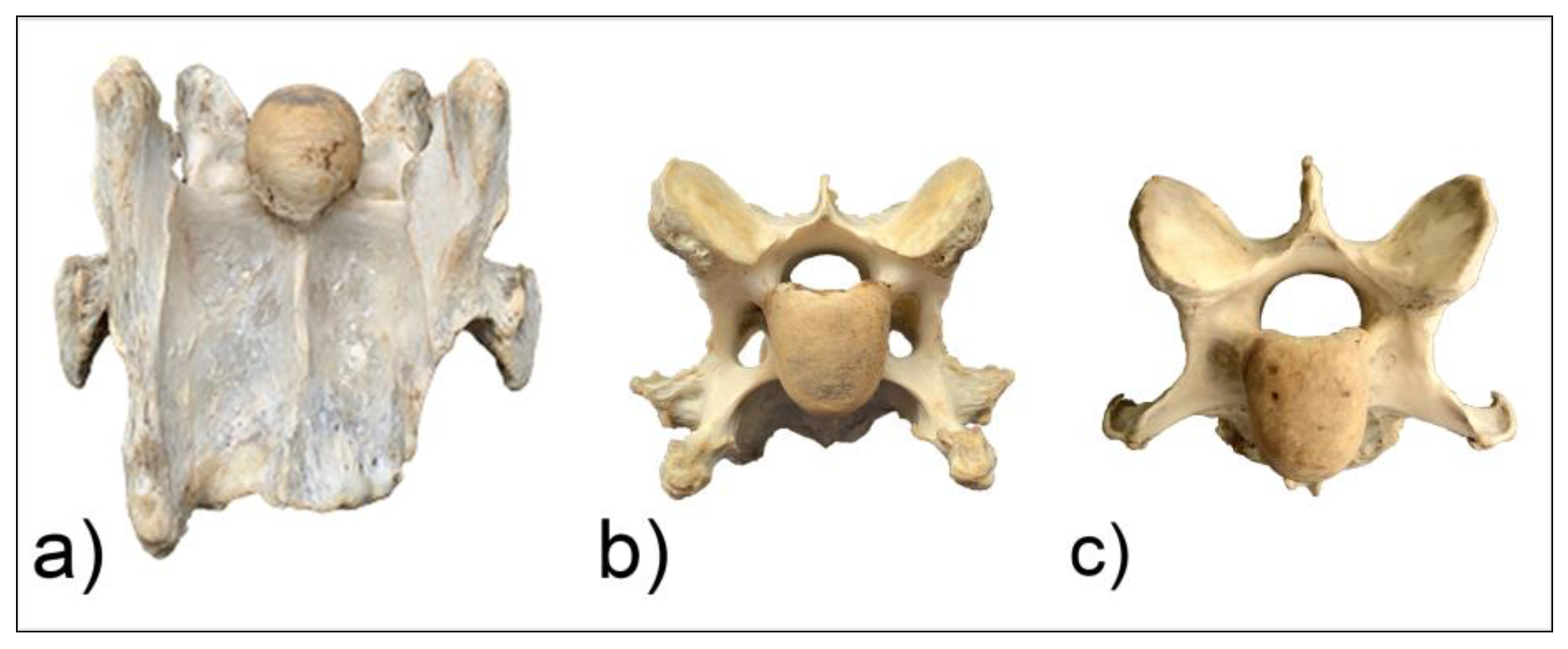 Cow Cervical Vertebrae