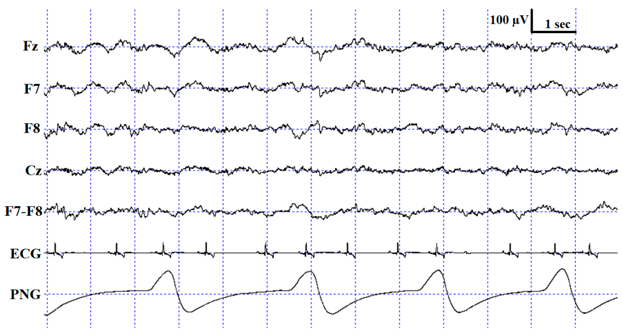 Animals 10 00927 i003