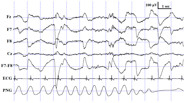 Animals 10 00927 i004