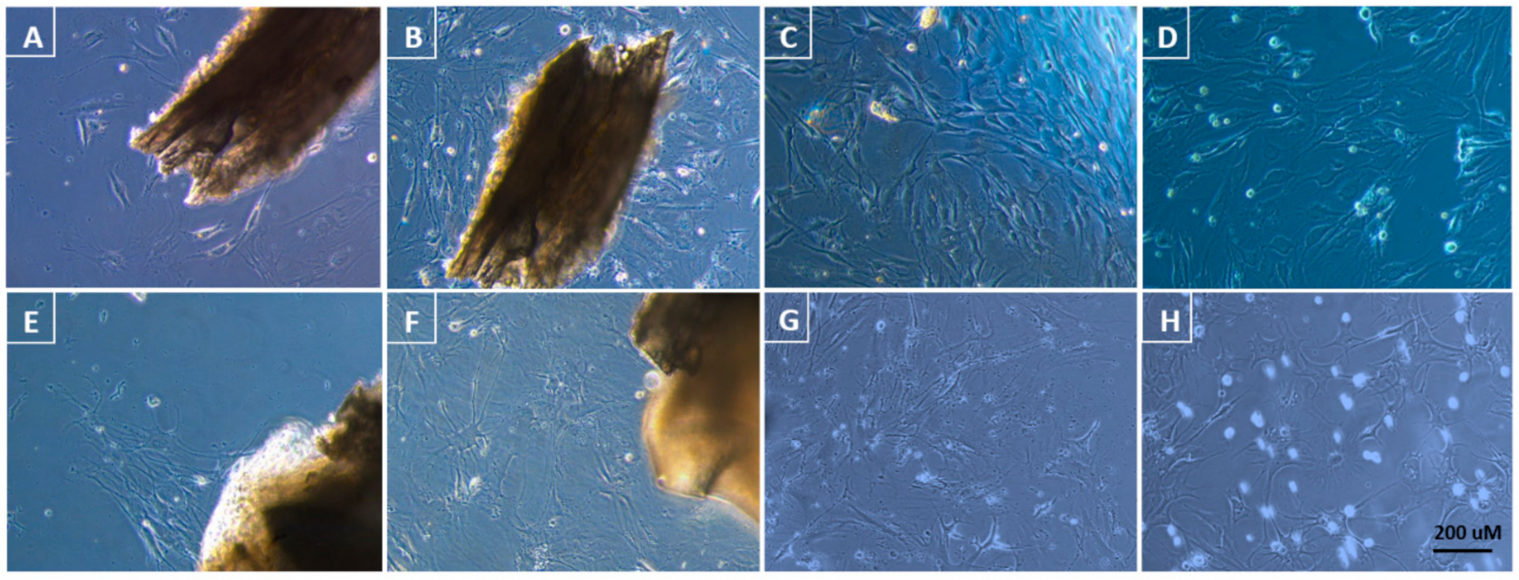 Animals | Free Full-Text | Establishing Cell Lines from Fresh or  Cryopreserved Tissue from the Great Crested Newt (Triturus cristatus): A  Preliminary Protocol