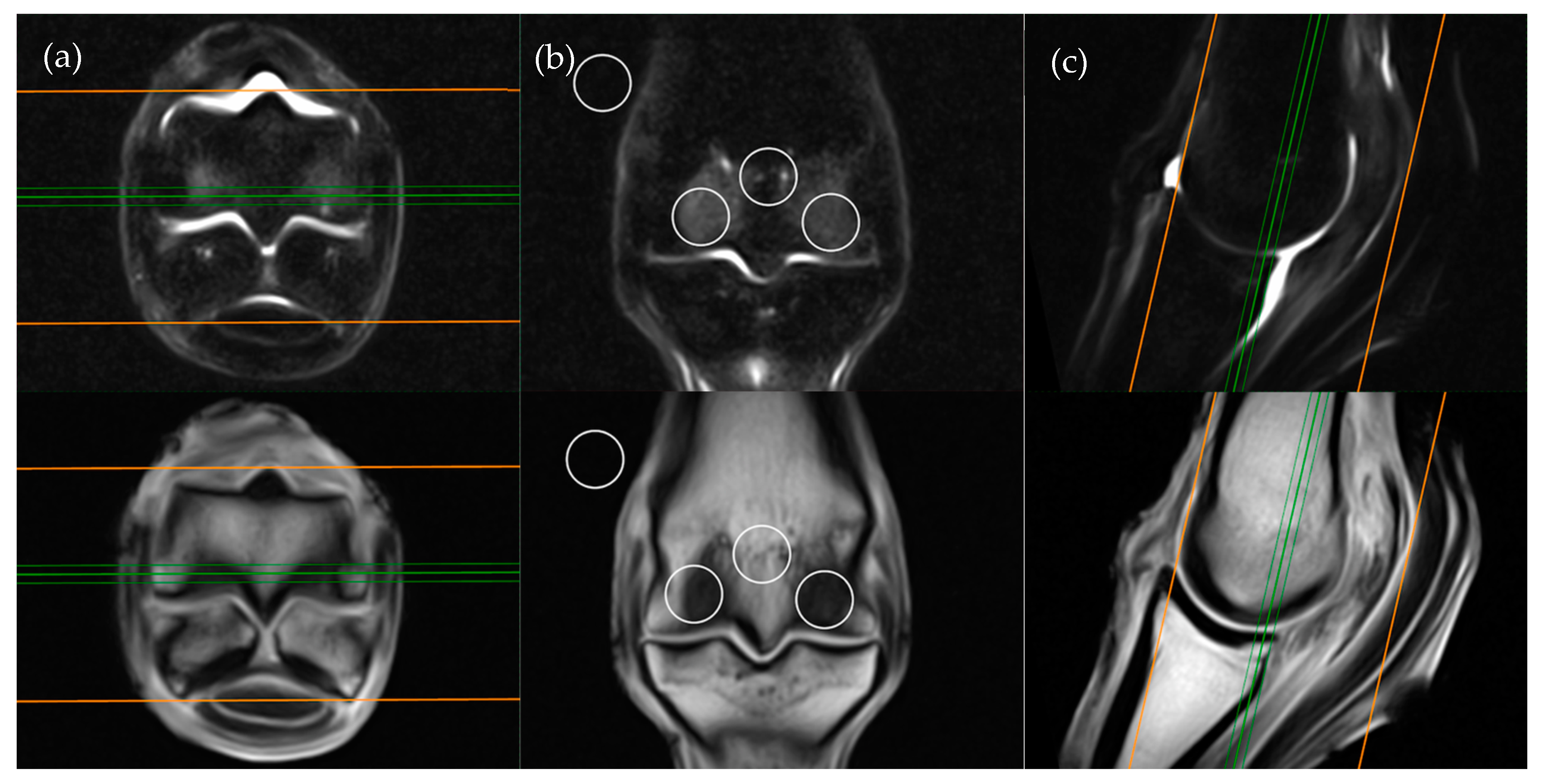 Animals Free Full Text Does The Low Field Mri Appearance Of Intraosseous Stir Hyperintensity In Equine Cadaver Limbs Change When Subjected To A Freeze Thaw Process