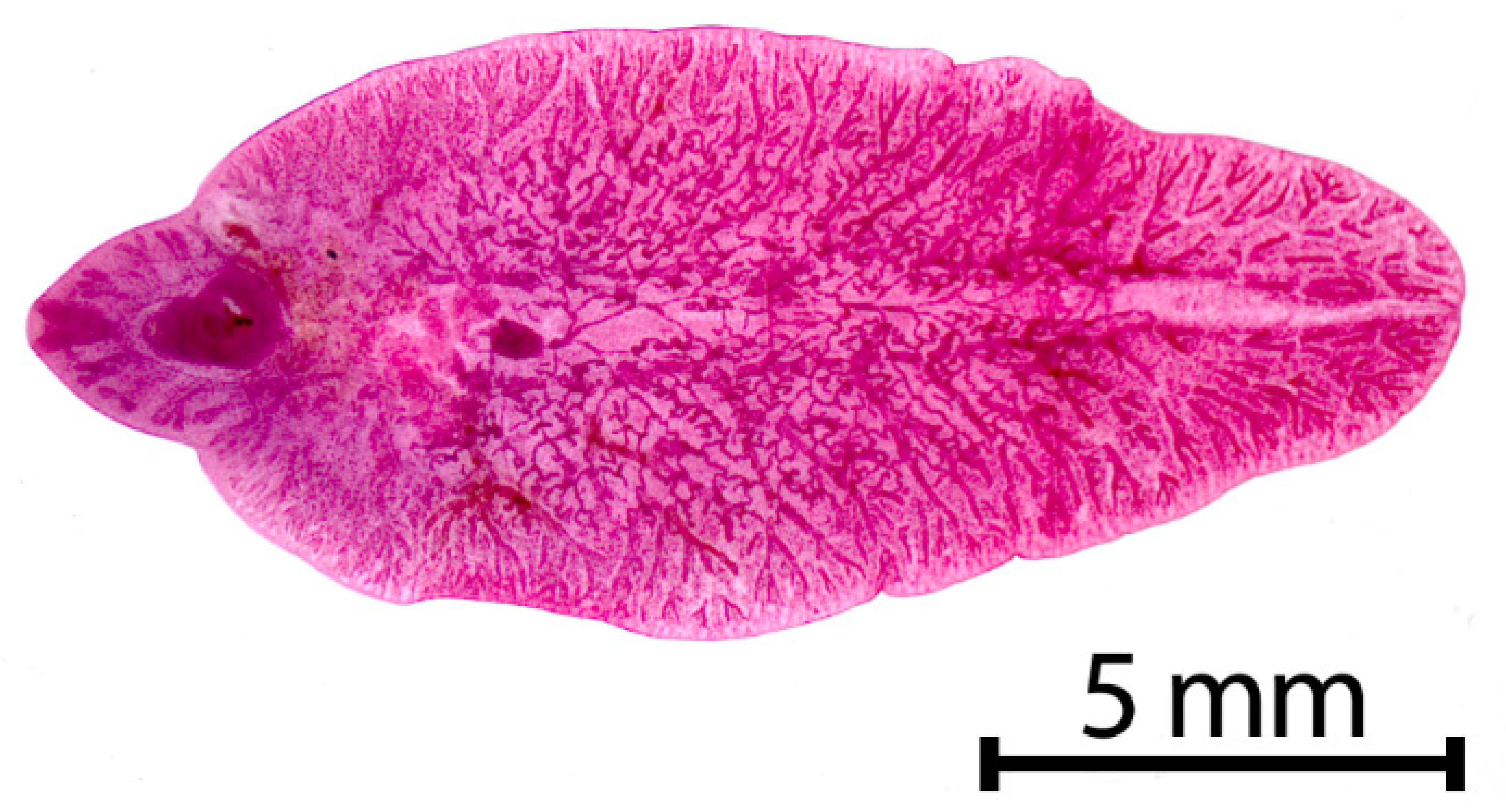 fascioliasis dicroceliosis)