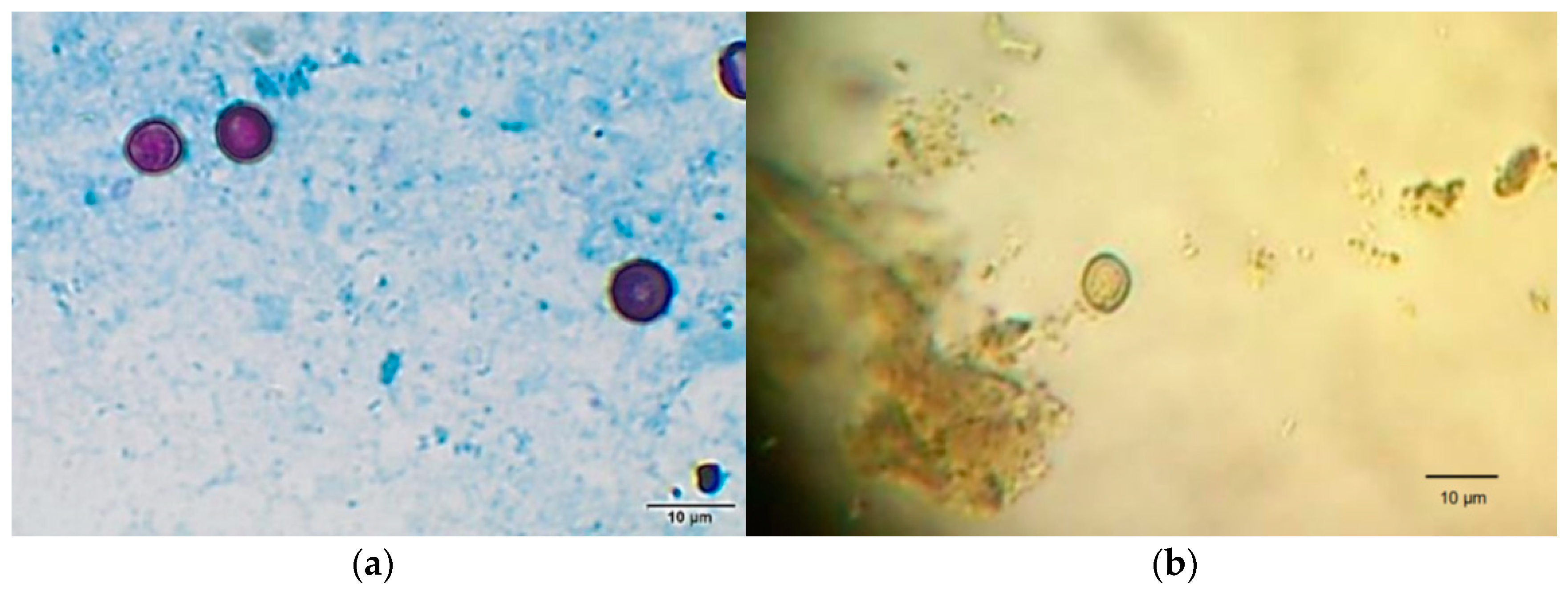 giardia spp)