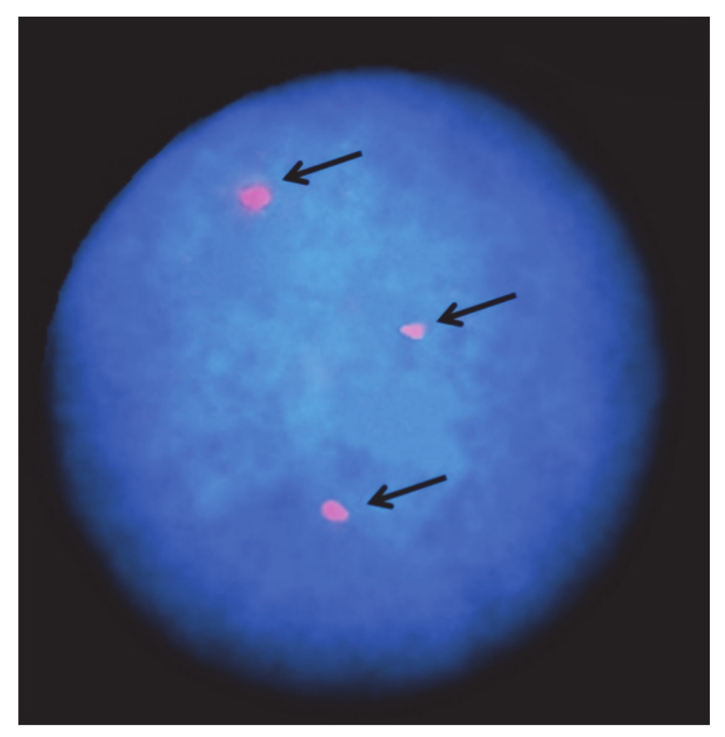 Animals | Free Full-Text | Chromosome Abnormalities and Fertility in Domestic Bovids: A Review Animals | Free Full-Text | Chromosome Abnormalities and Fertility in Domestic Bovids: A Review