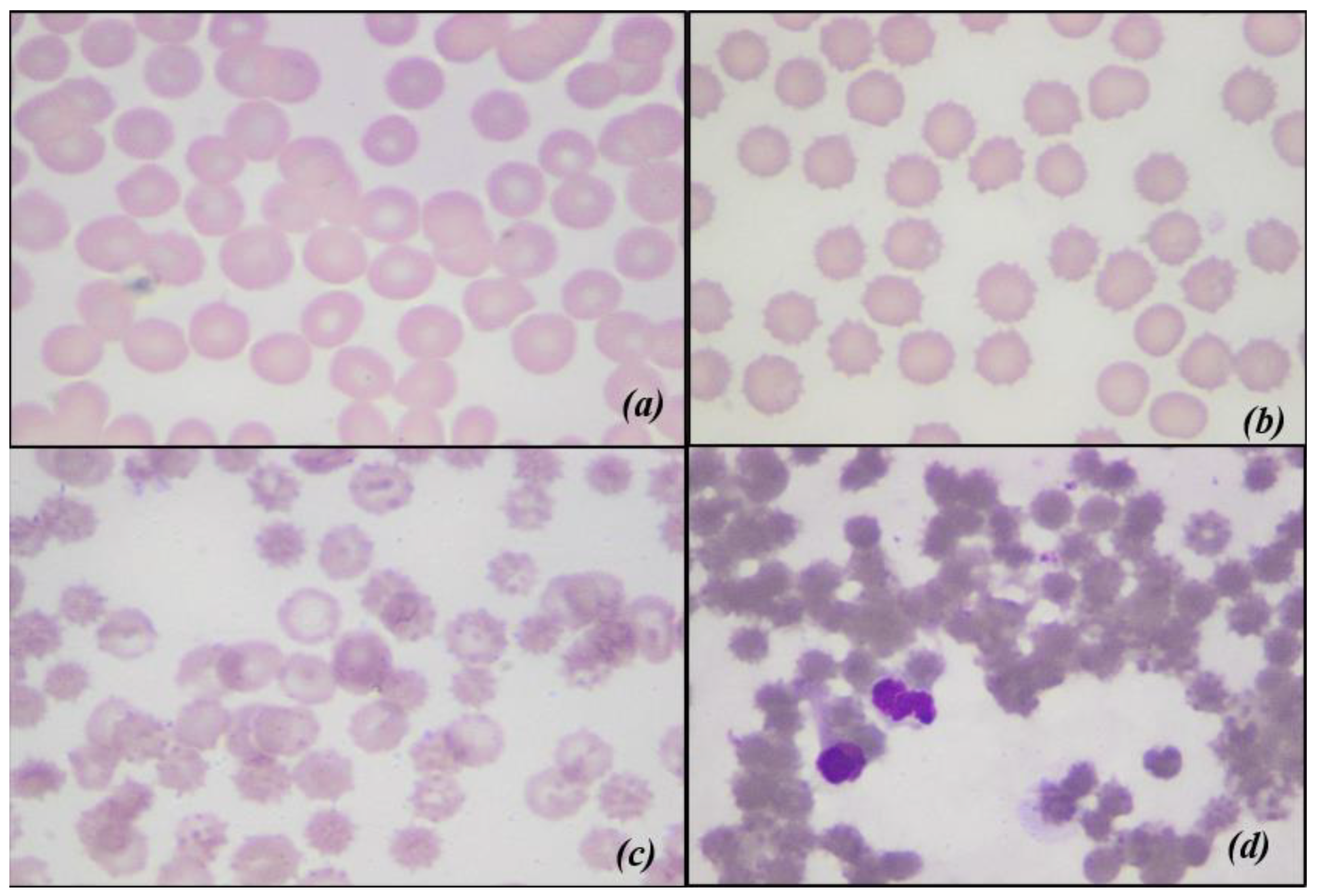 Animals | Free Full-Text | Effect of Leukoreduction on Hematobiochemical Parameters and Storage Hemolysis in Canine Whole Blood Units Animals | Free Full-Text | Effect of Leukoreduction on Hematobiochemical Parameters and Storage Hemolysis in Canine Whole Blood Units