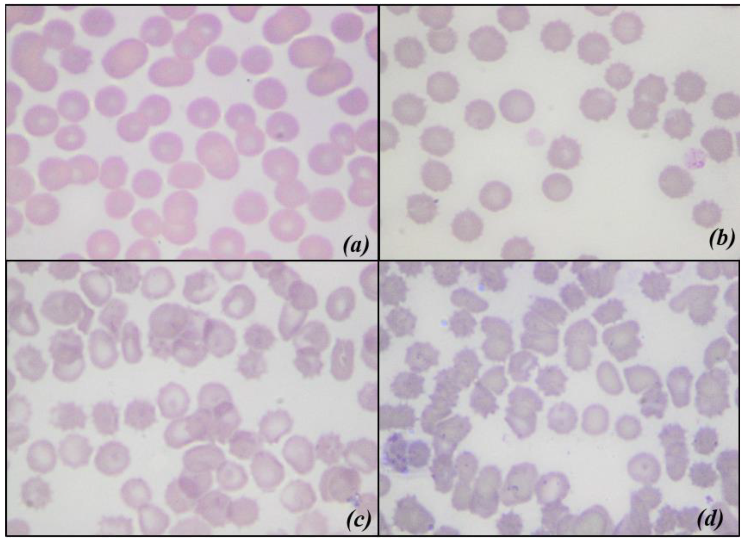 Animals | Free Full-Text | Effect of Leukoreduction on Hematobiochemical Parameters and Storage Hemolysis in Canine Whole Blood Units Animals | Free Full-Text | Effect of Leukoreduction on Hematobiochemical Parameters and Storage Hemolysis in Canine Whole Blood Units