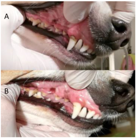 can an overshot jaw correct itself supplier