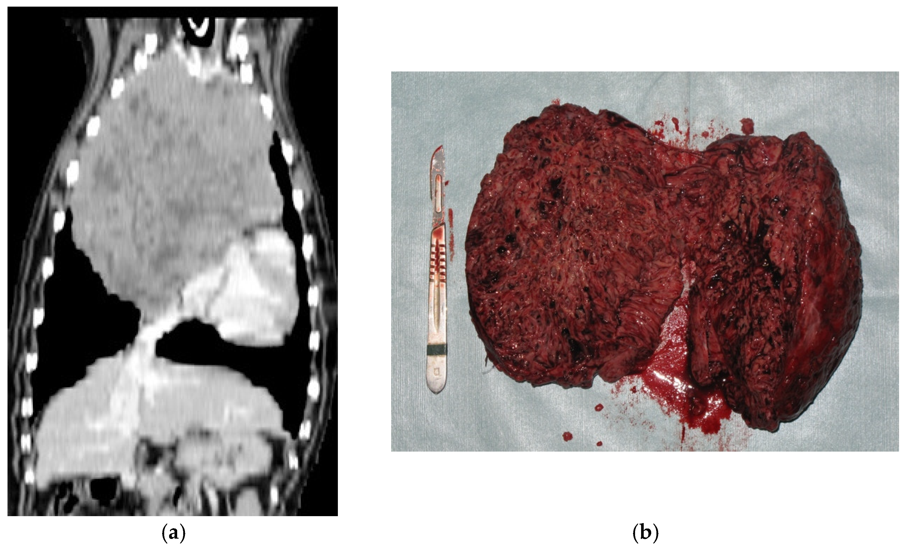 Animals Free Full Text Canine Epithelial Thymic Tumors Outcome In 28 Dogs Treated By Surgery Html